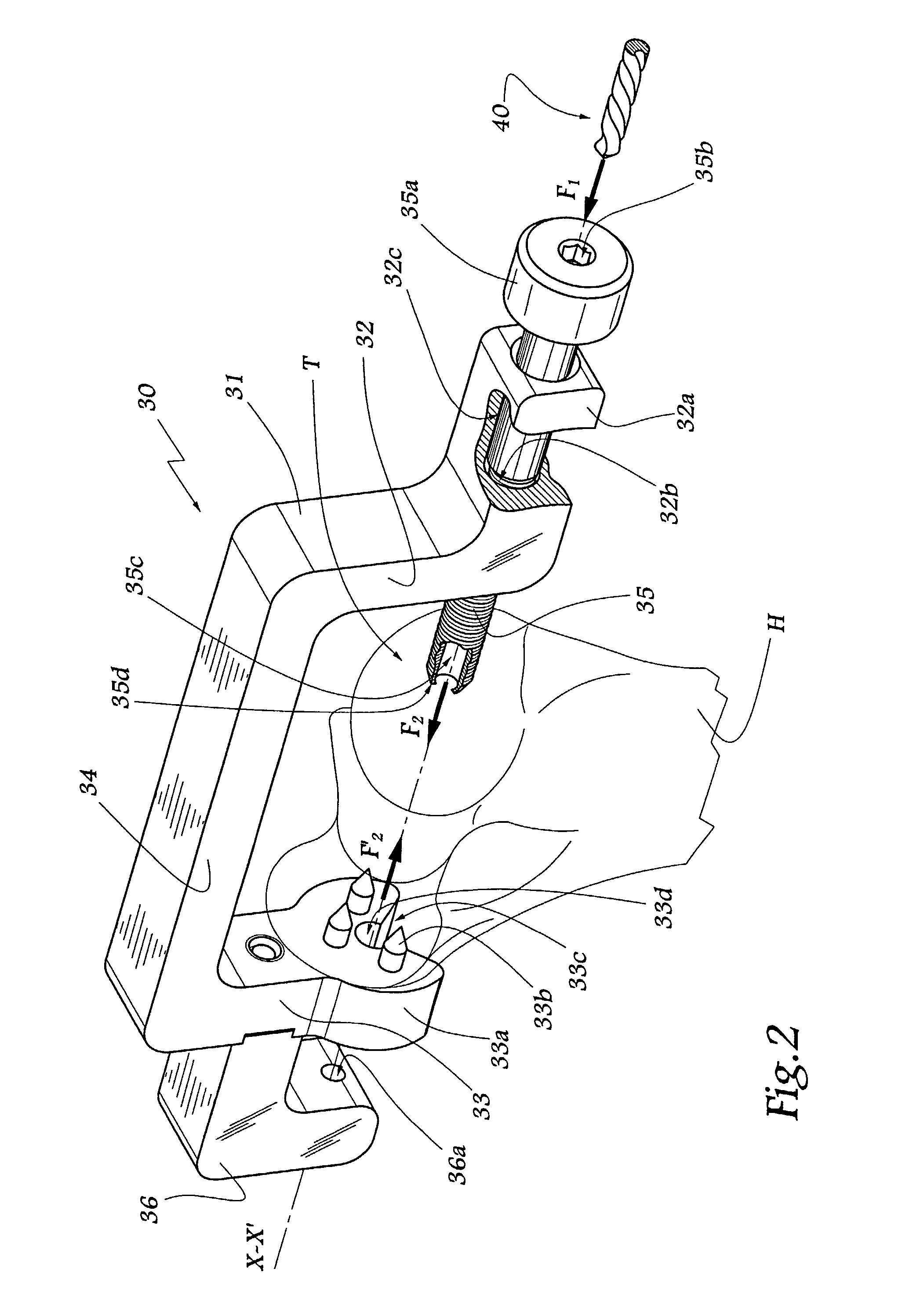 Ancillary tool for fitting a humeral component of an elbow prosthesis