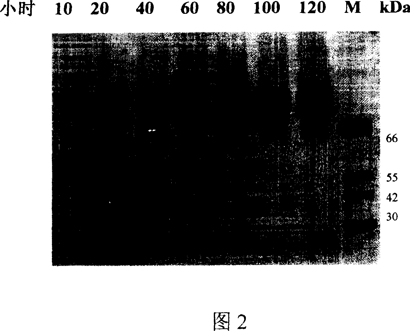 Production for phytase with high living rate high temp. resisting by pichia