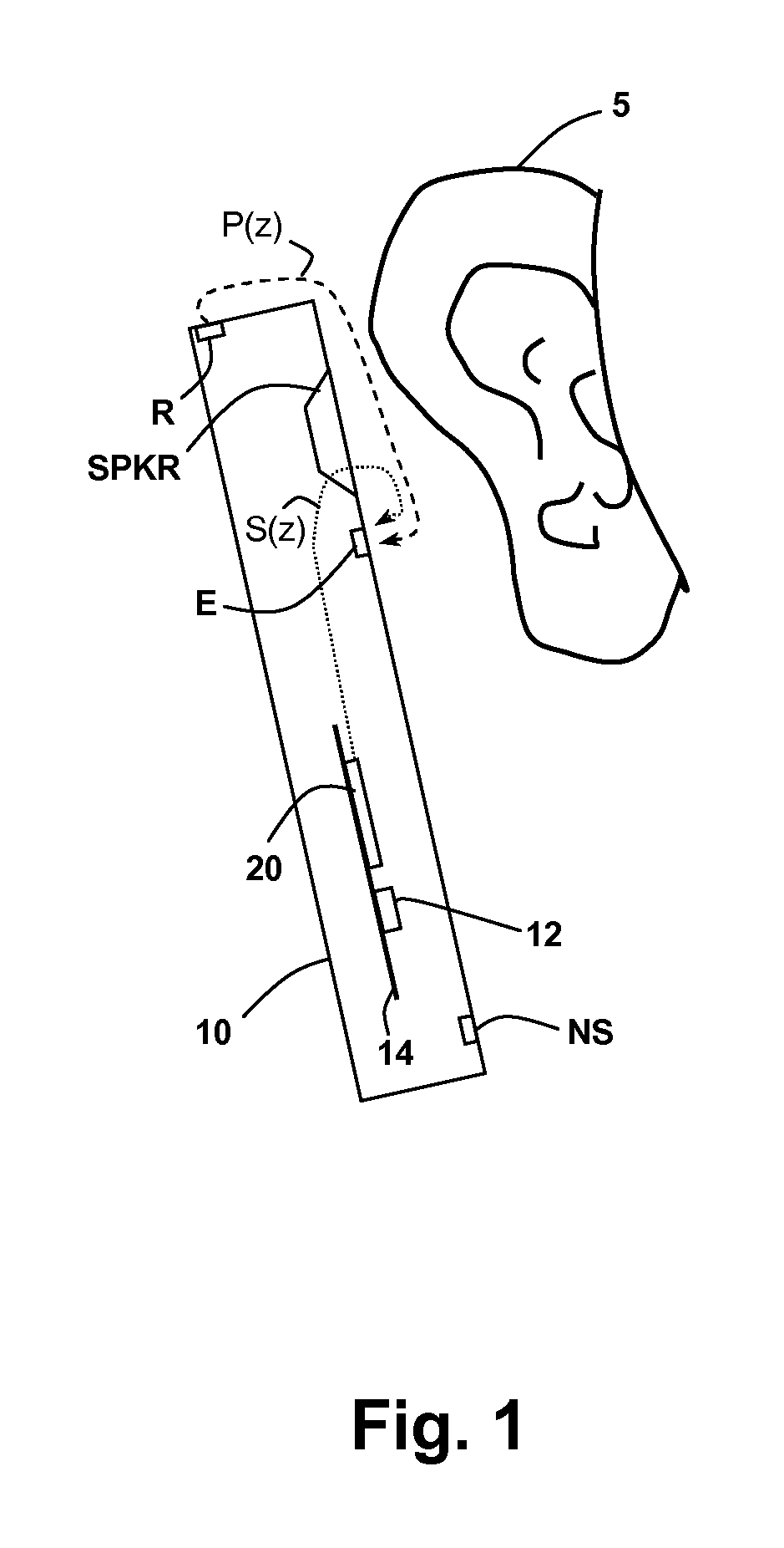 Sidetone management in an adaptive noise canceling (ANC) system including secondary path modeling