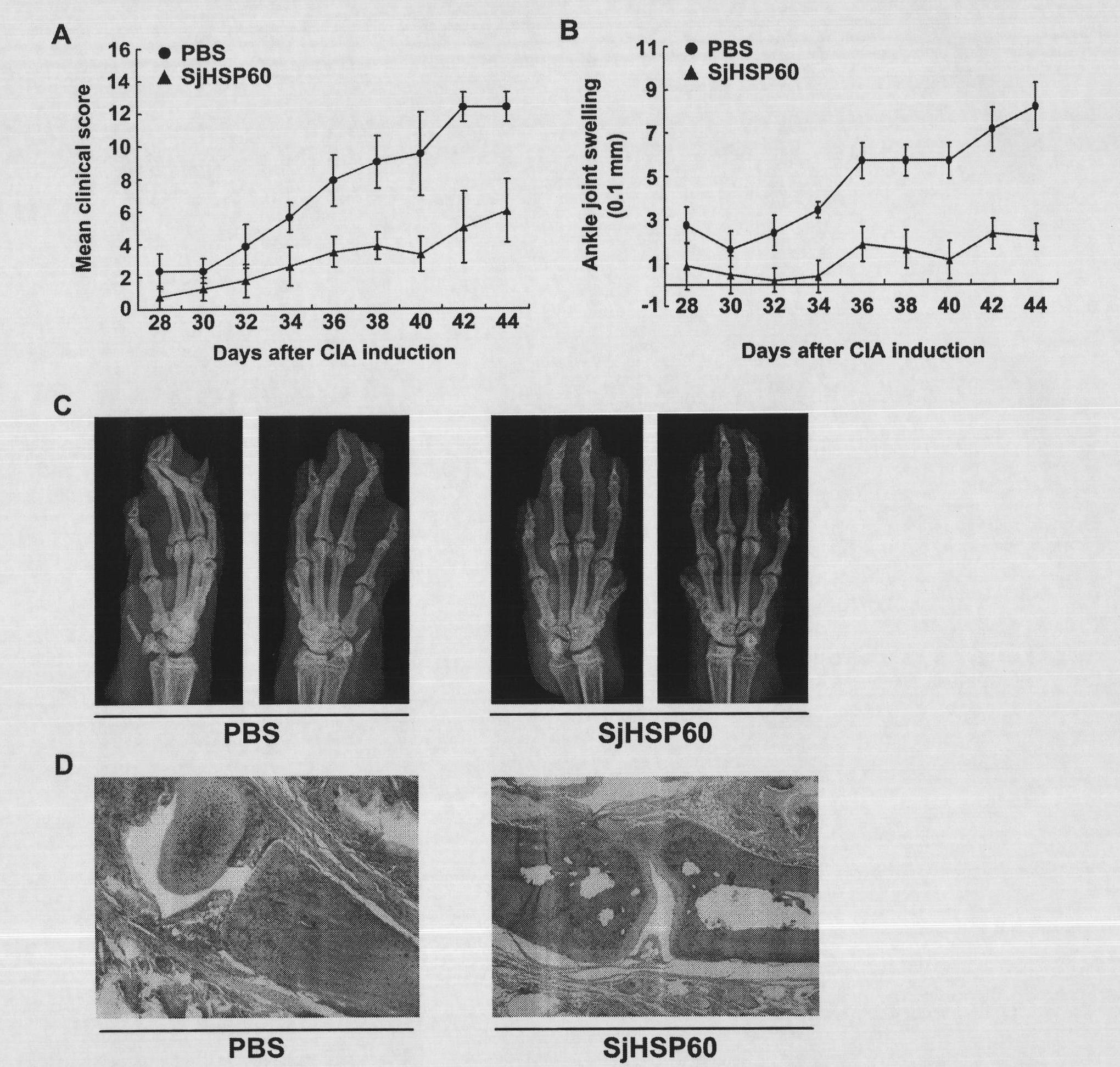 Antigen capable of increasing CD4 + CD25 + Foxp3 + regulatory T cells and application thereof