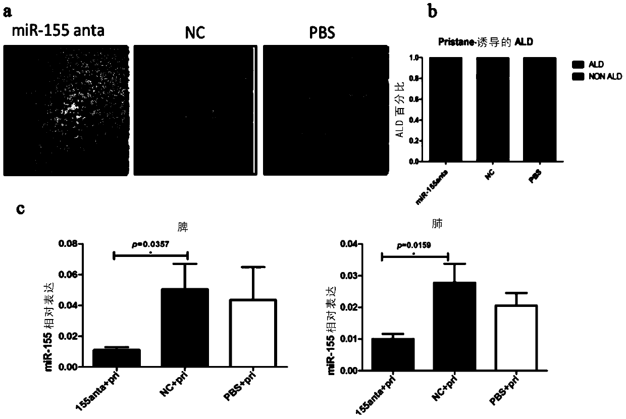 Use of mir-155 in the preparation of medicines for preventing and treating acute lung injury