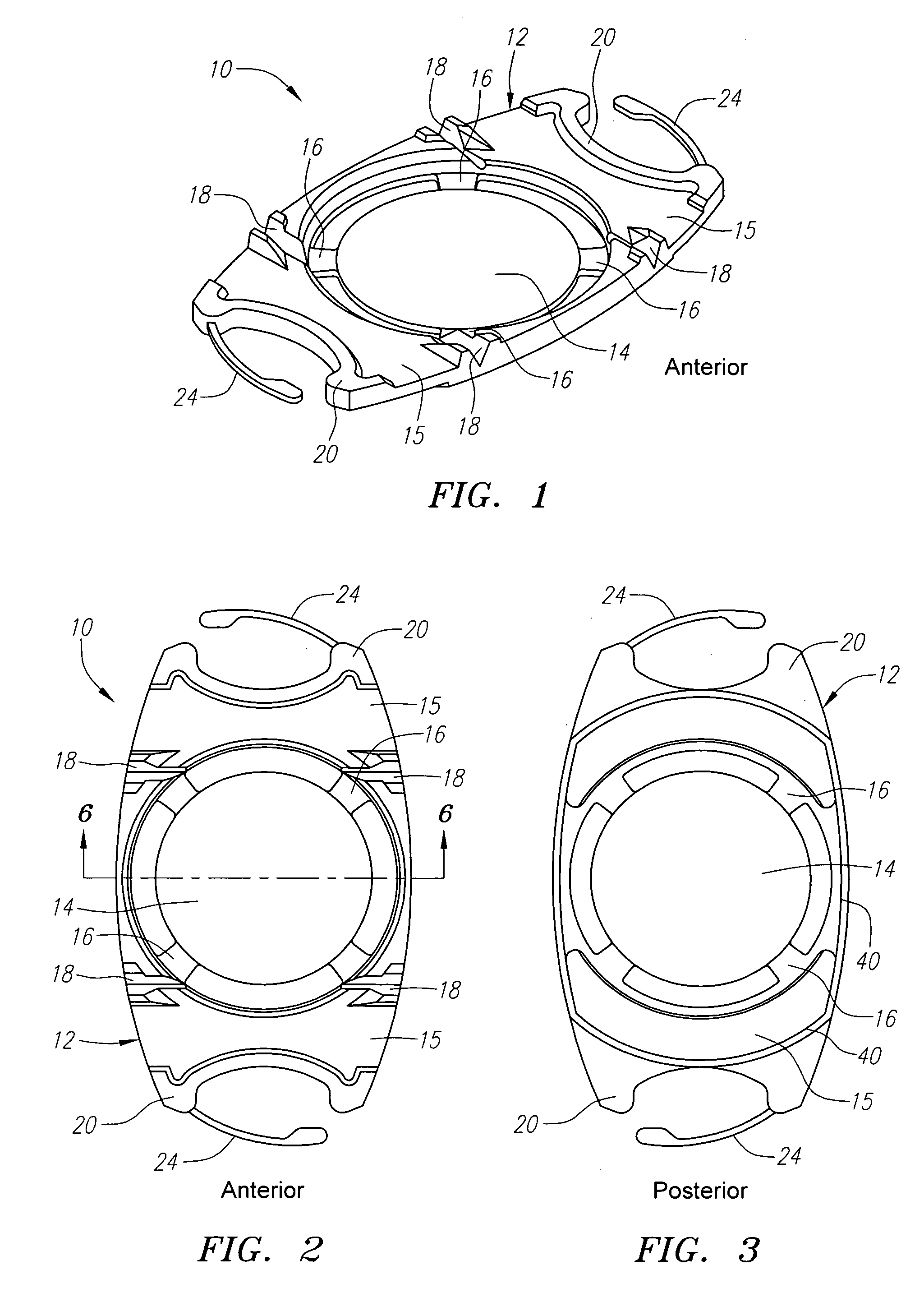 Floating optic accommodating intraocular lens