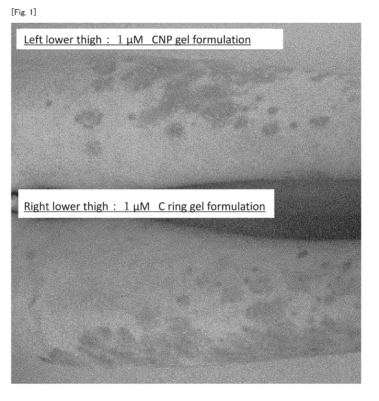 Cnp cyclic peptide, and medicine, external preparation and cosmetic each containing said cyclic peptide