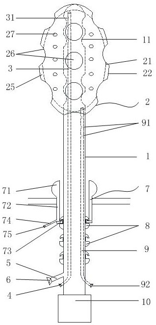 Abdominal cavity washing drainage device