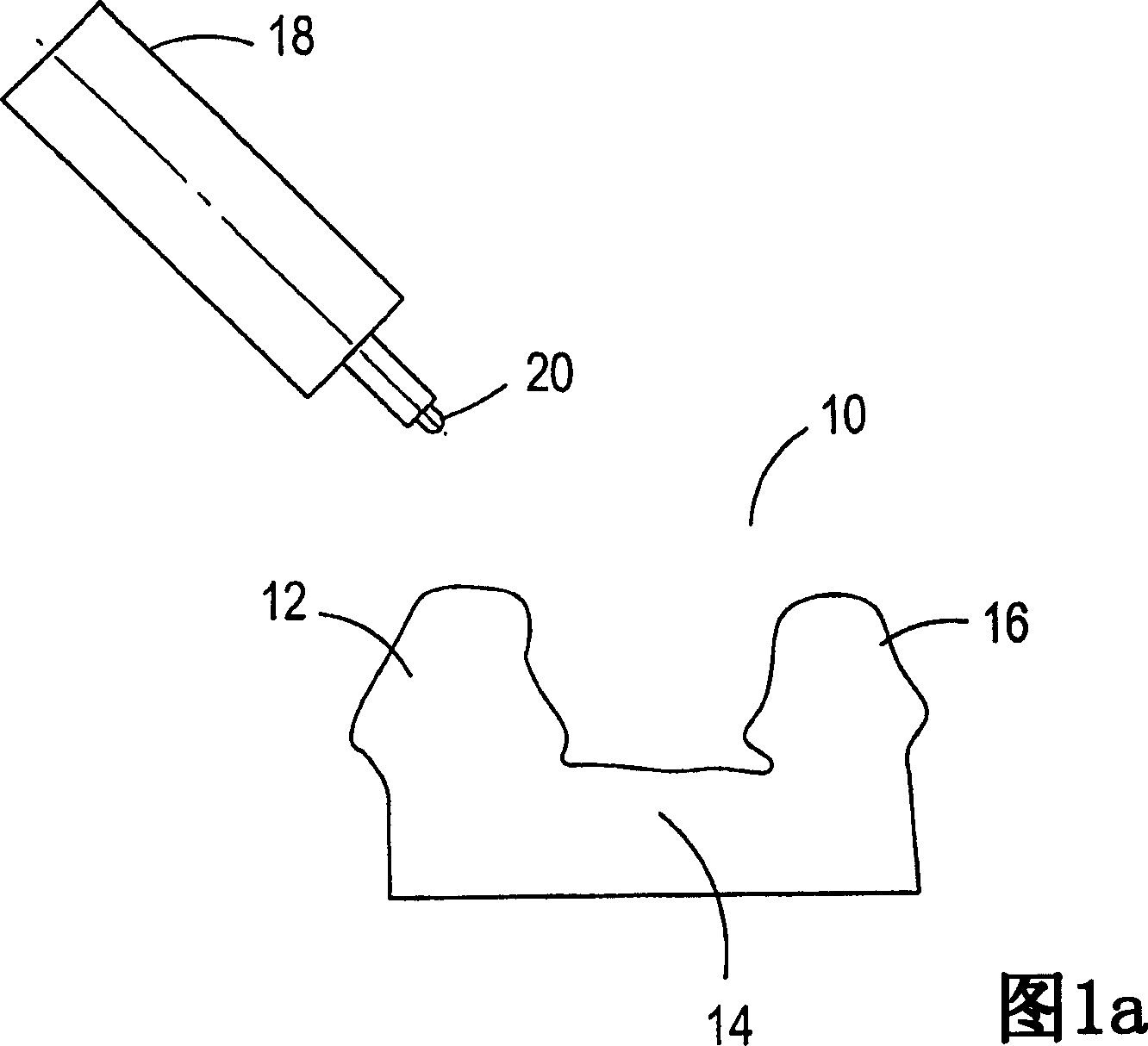 Manufacture of dental prostheses