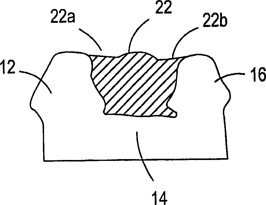 Manufacture of dental prostheses