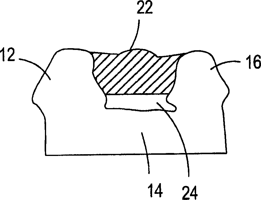 Manufacture of dental prostheses