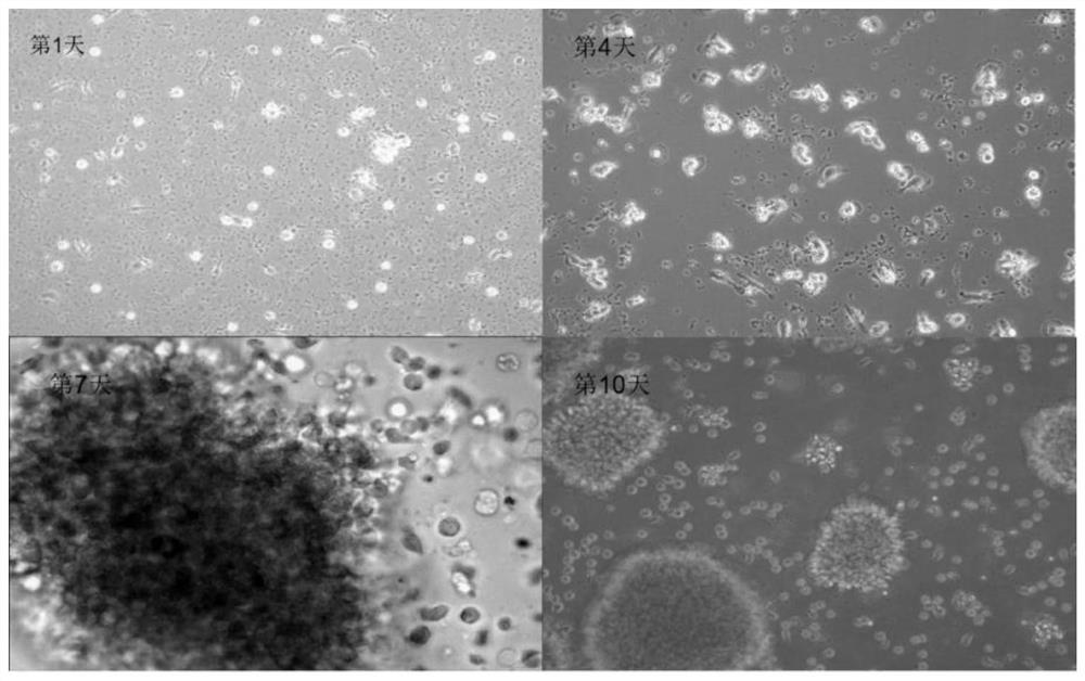 Culture method for inducing DC-CIK amplification