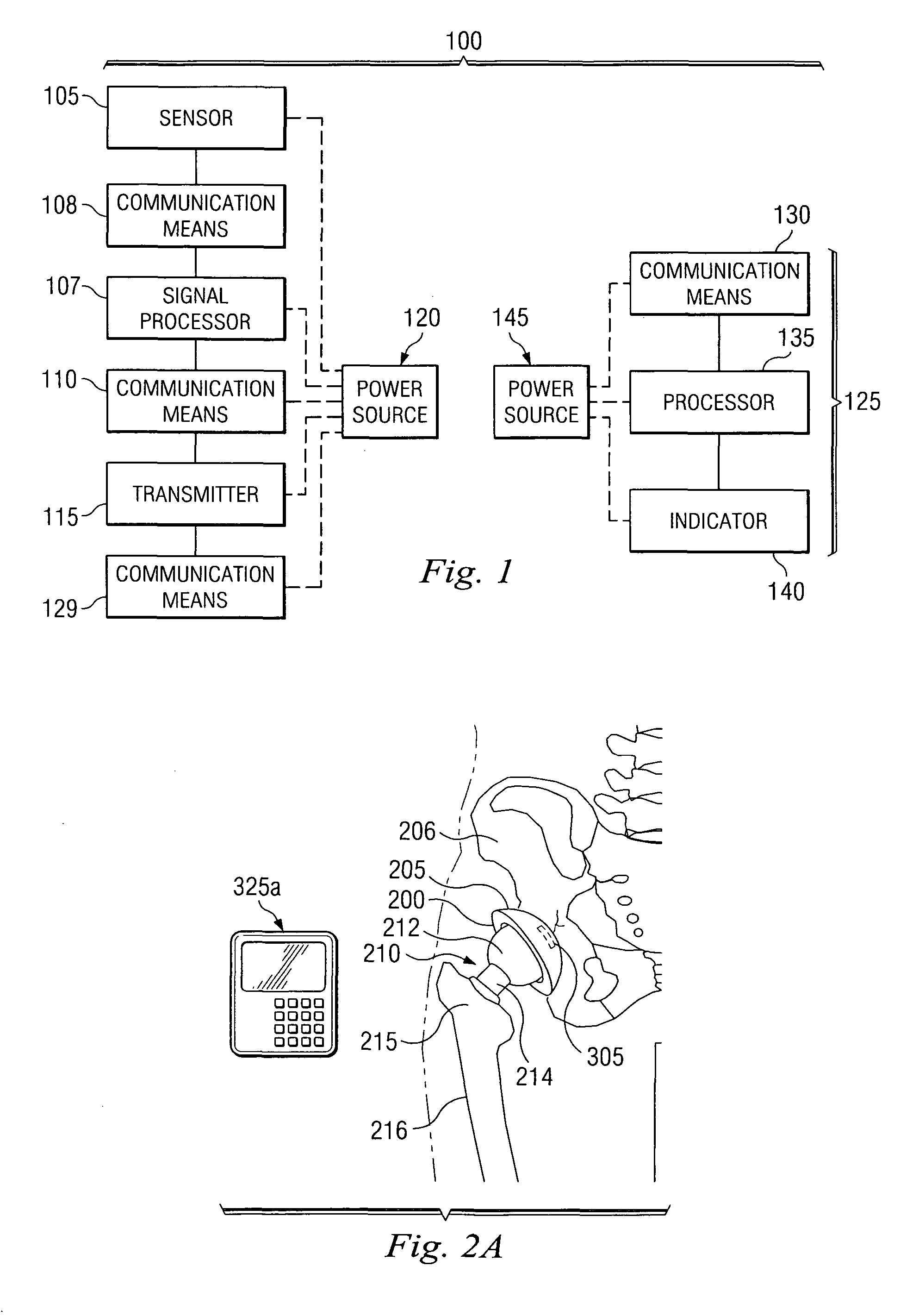 Methods for detecting osteolytic conditions in the body