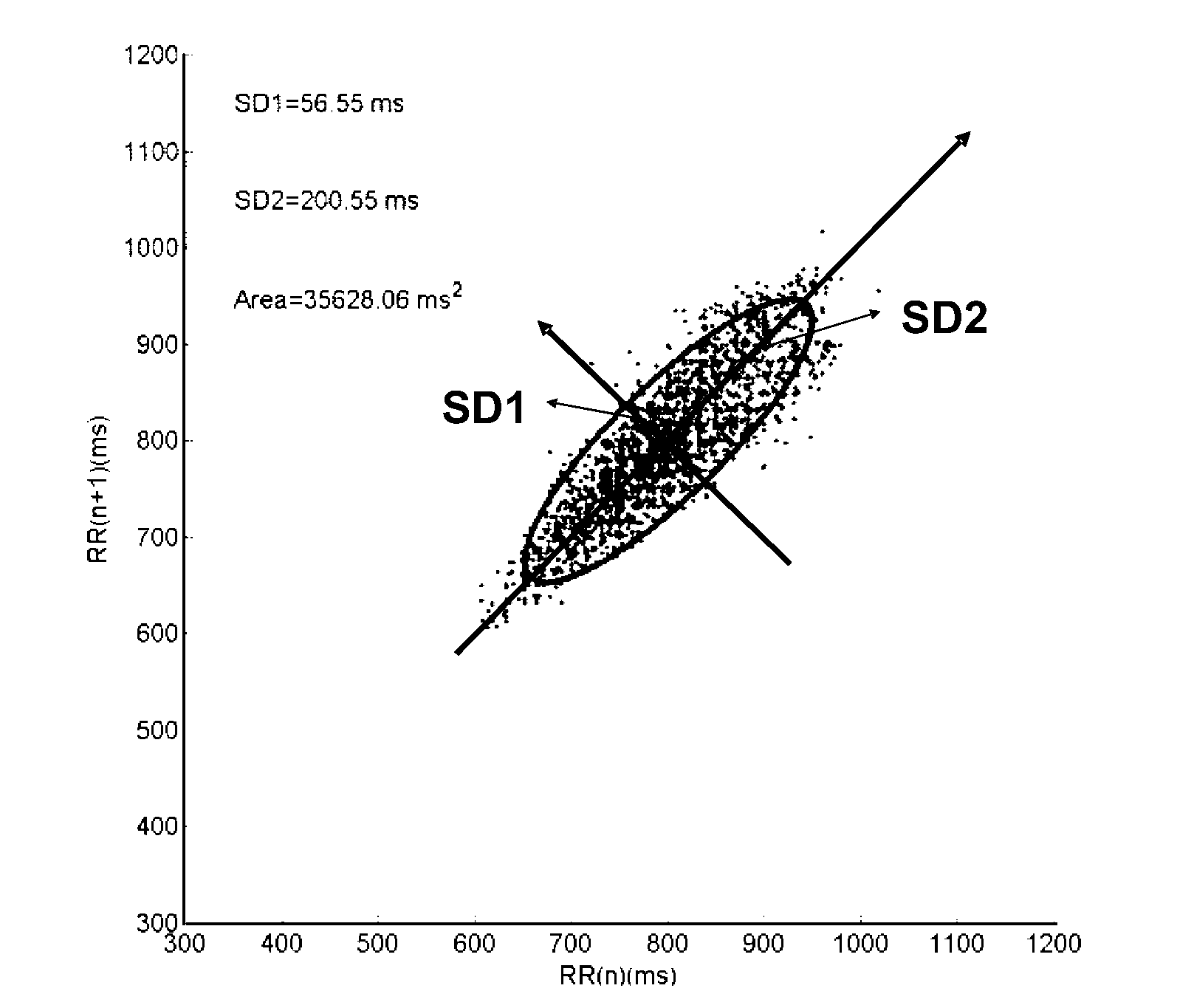 Method for analyzing irreversible apneic coma (IAC)