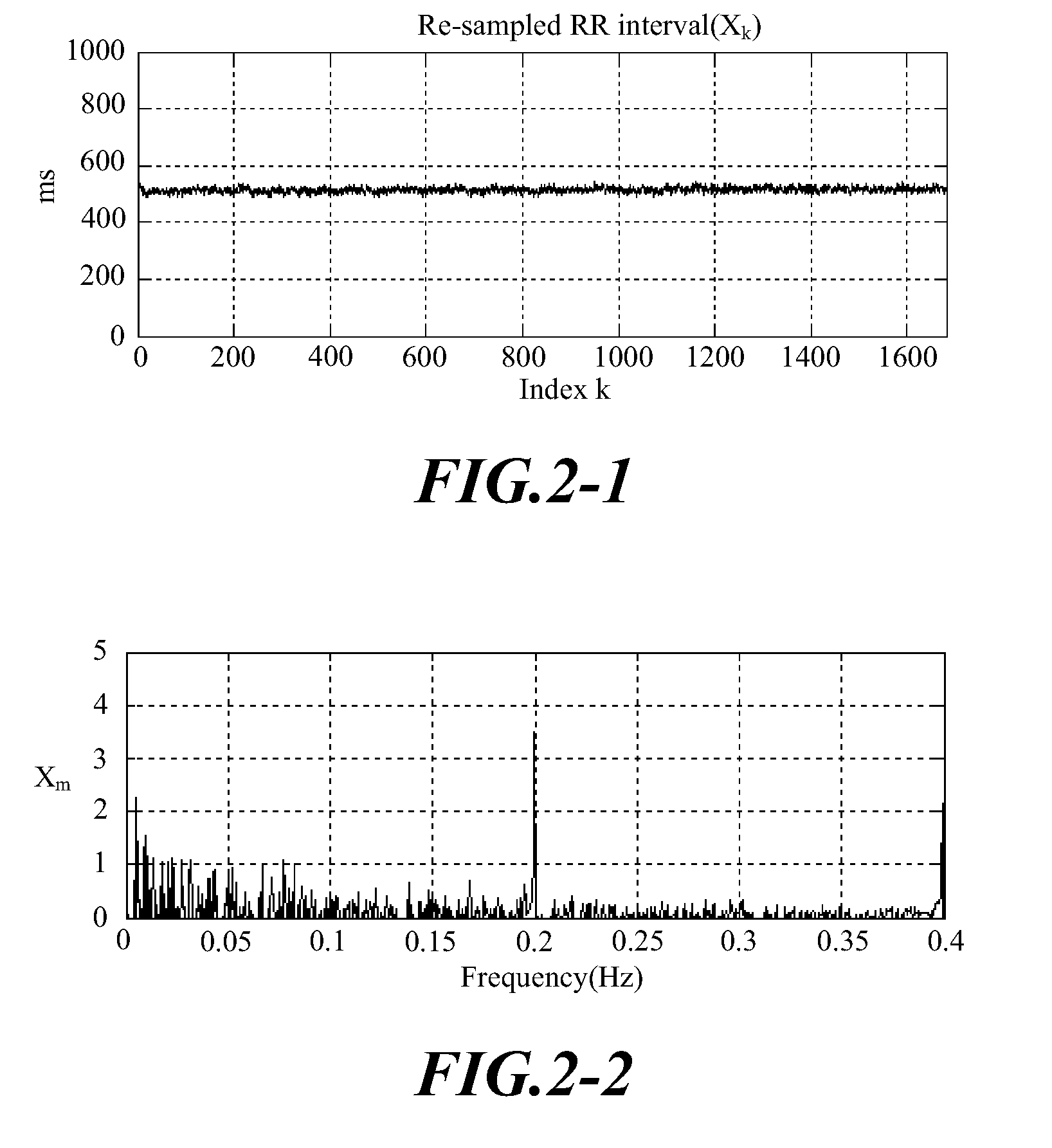 Method for analyzing irreversible apneic coma (IAC)