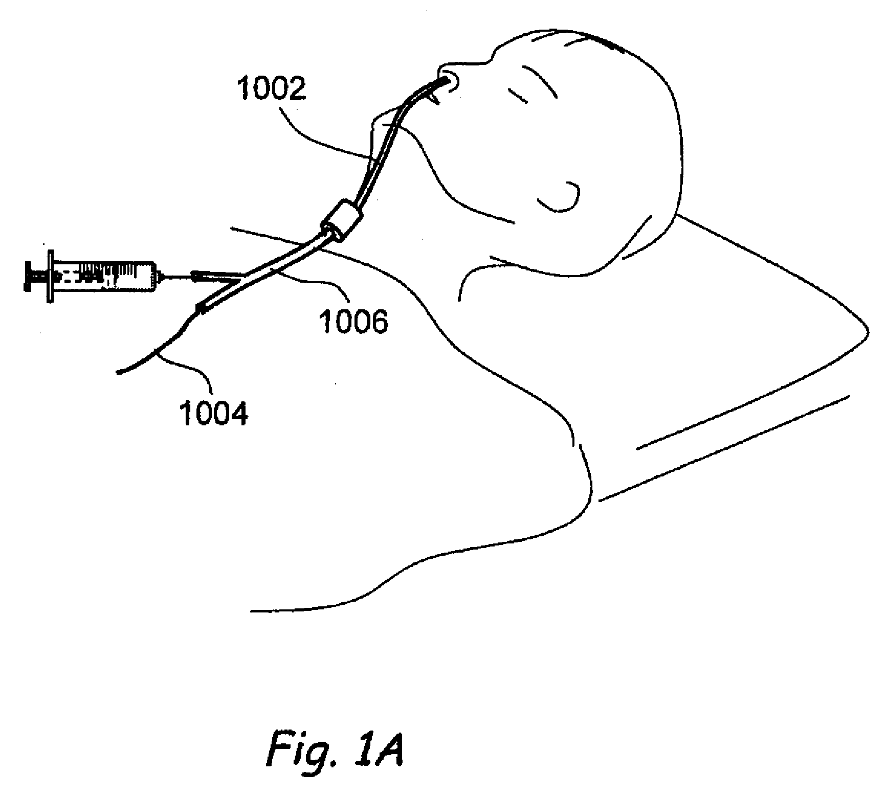 Apparatus and Methods for Dilating and Modifying Ostia of Paranasal Sinuses and Other Intranasal or Paranasal Structures