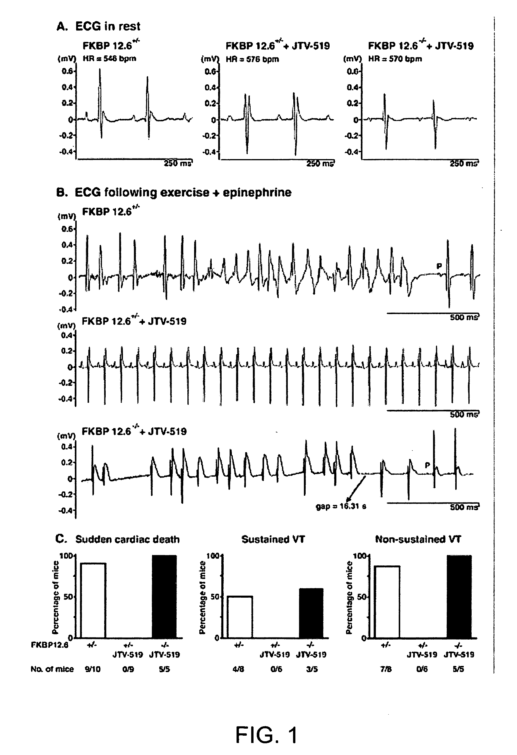 Novel anti-arrythmic and heart failure drugs that target the leak in the ryanodine receptor (RYR2)