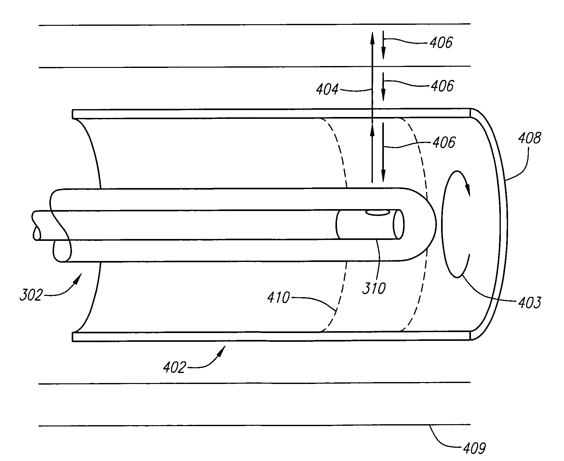 Systems and methods for automatic time-gain compensation in an ultrasound imaging system