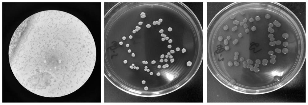 Standard strain of Yersinia enterocolitica containing specific molecular targets and its detection and application