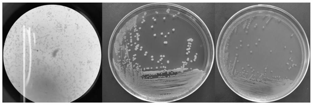 Standard strain of Yersinia enterocolitica containing specific molecular targets and its detection and application