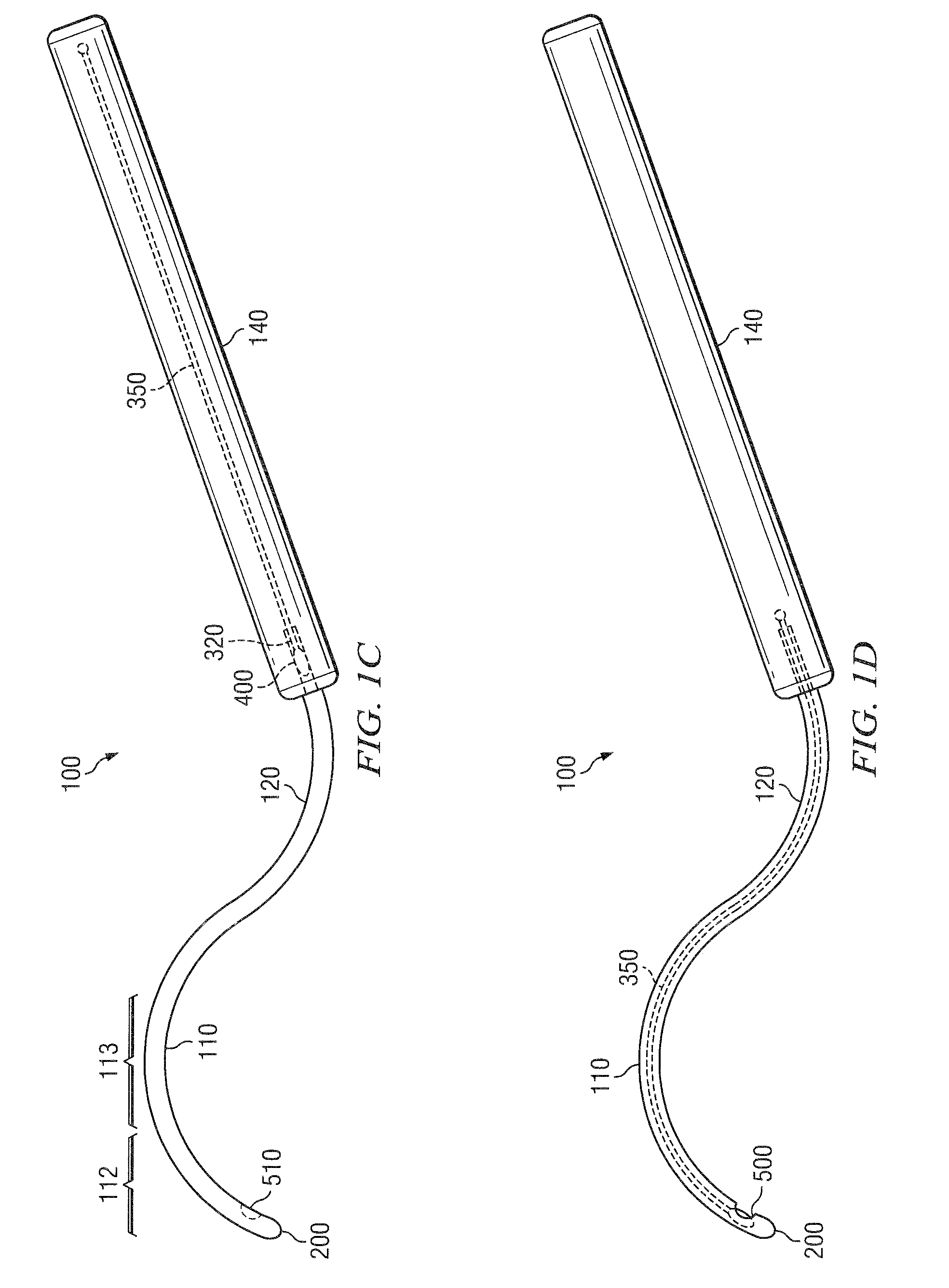 Methods and devices for minimally-invasive extraocular delivery of radiation to the posterior portion of the eye