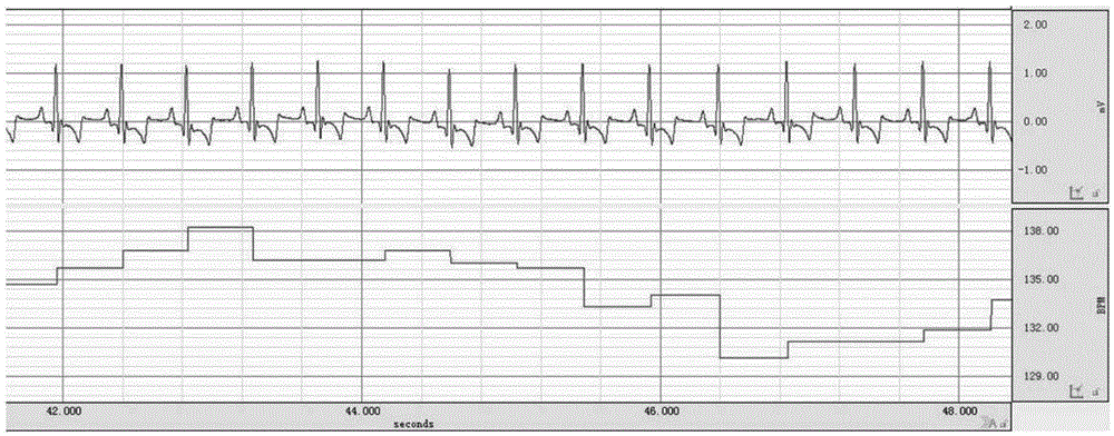 A minimally invasive intervention method for establishing a heart failure animal model