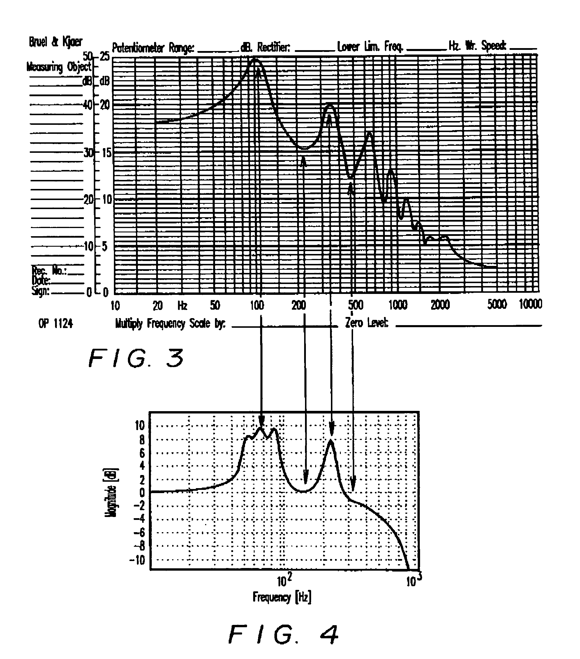 Electronic stethoscope