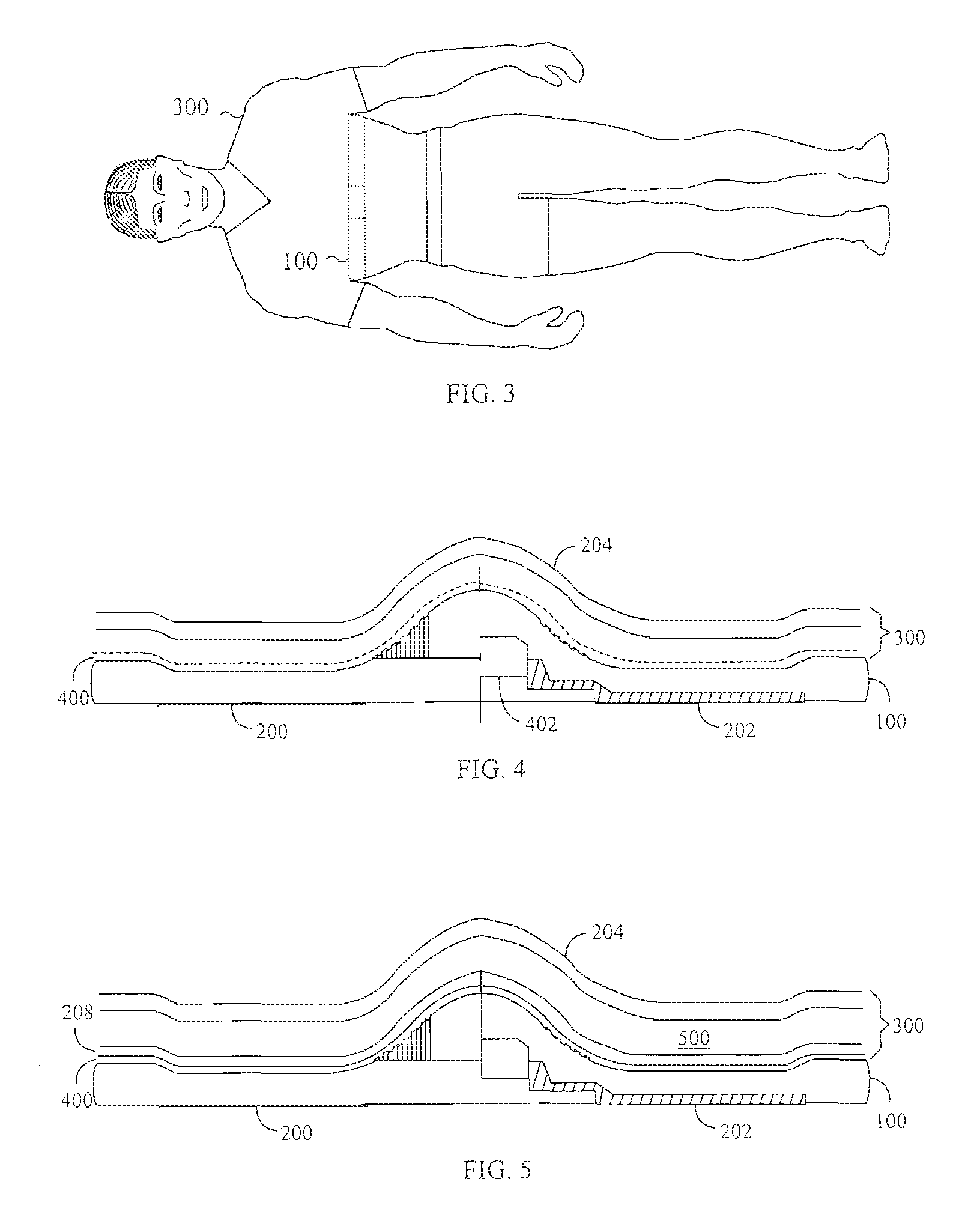 Electrode structure