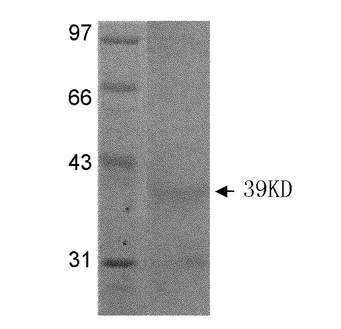 Japanese blood fluke protein and application thereof