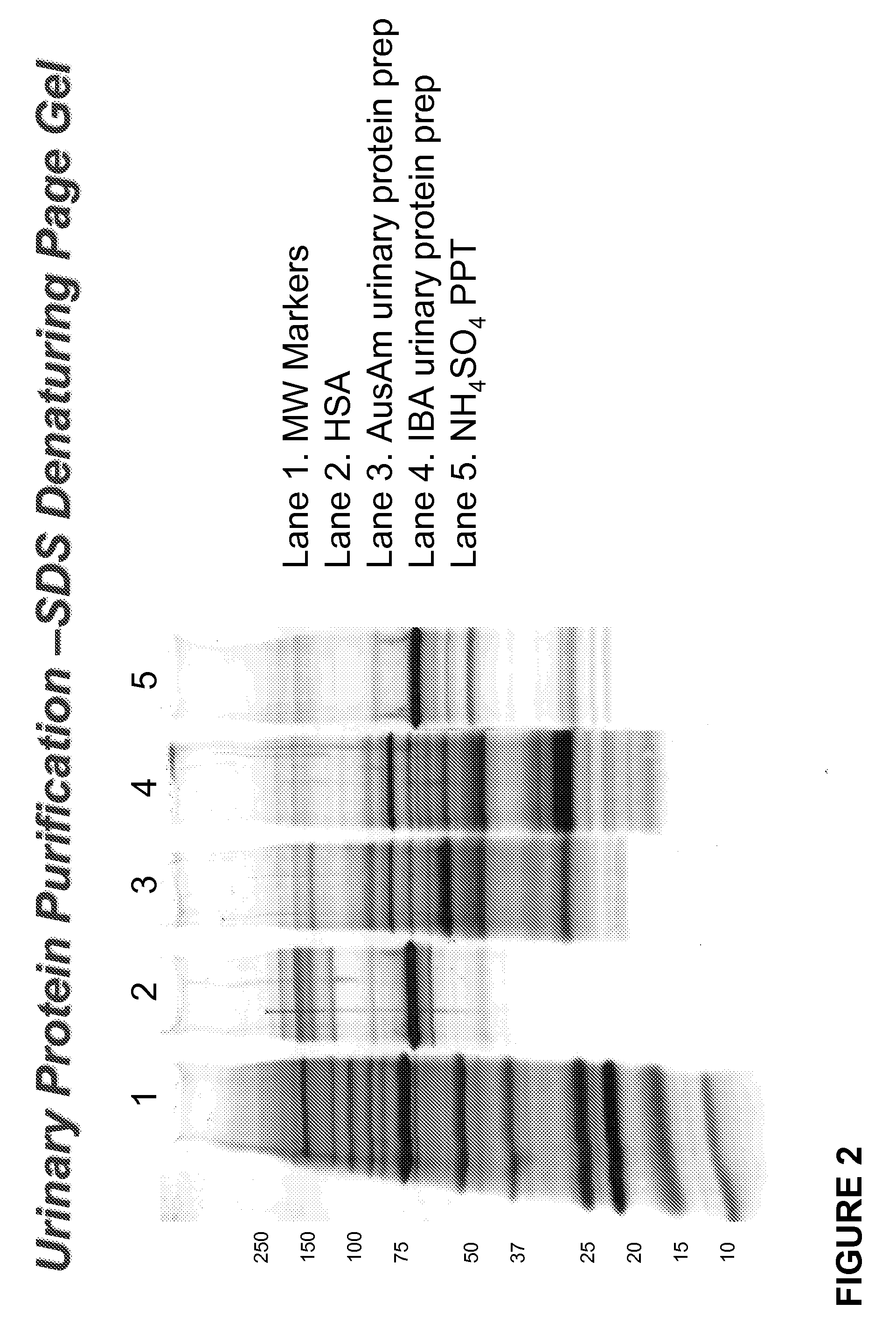 Methods for Early Diagnosis of Kidney Disease