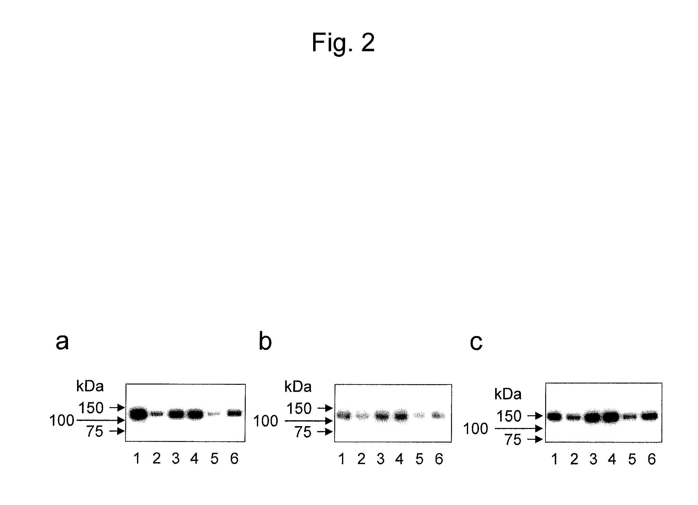 Antibody for detecting epithelial ovarian cancer marker and method for diagnosing epithelial ovarian cancer