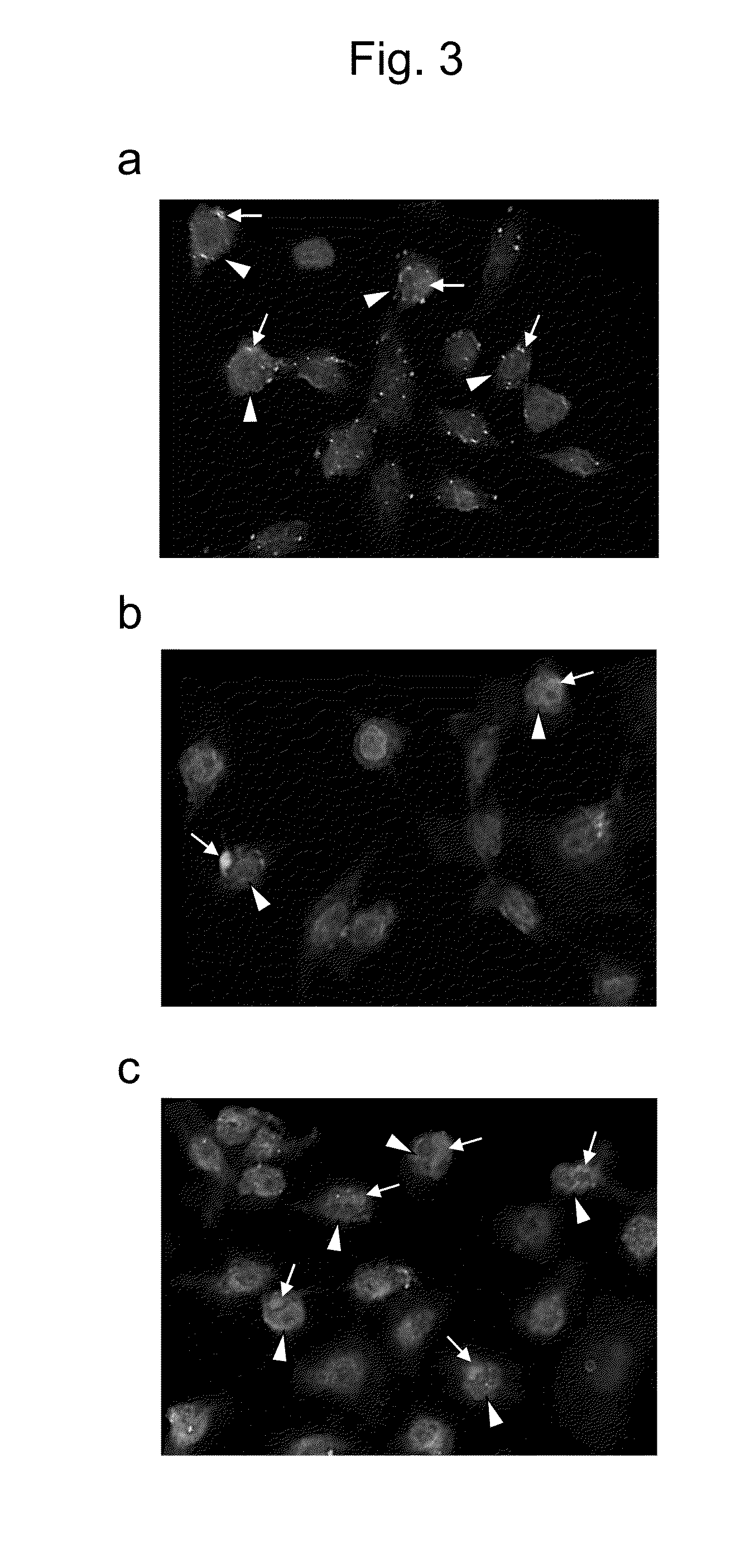 Antibody for detecting epithelial ovarian cancer marker and method for diagnosing epithelial ovarian cancer