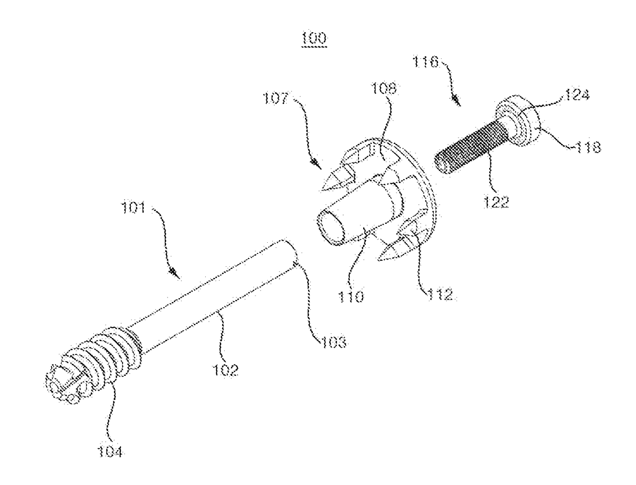 Bone fusion device