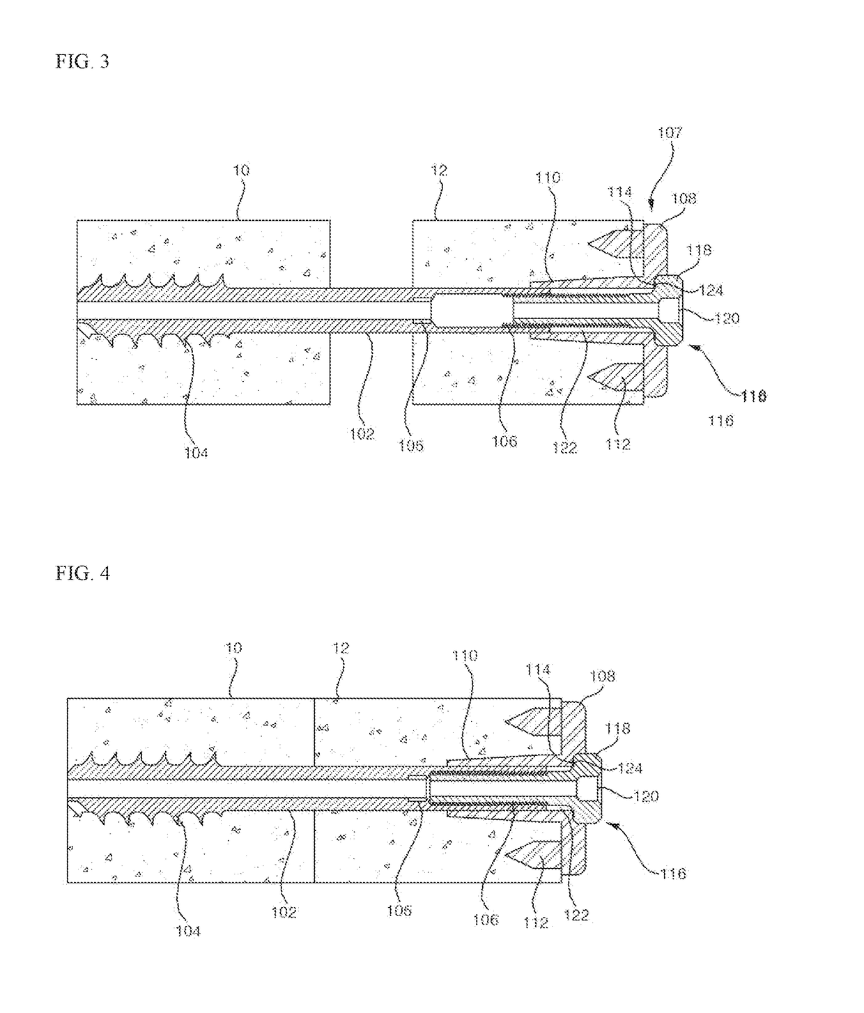 Bone fusion device