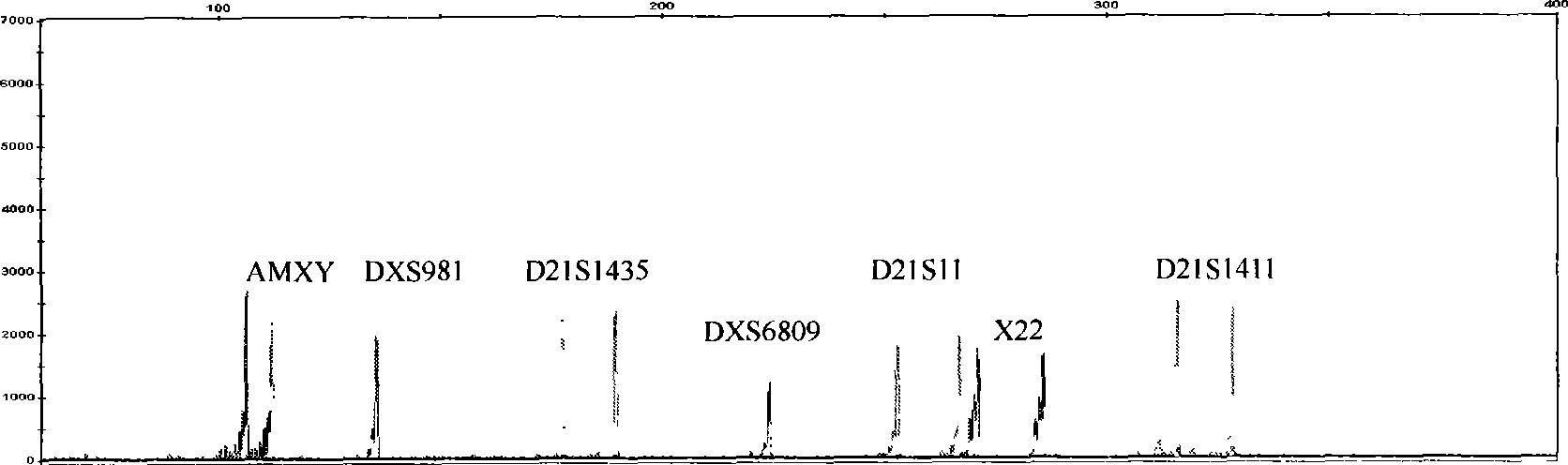 Reagent box for detecting No 21 chromosome and idiochromosome number abnormality