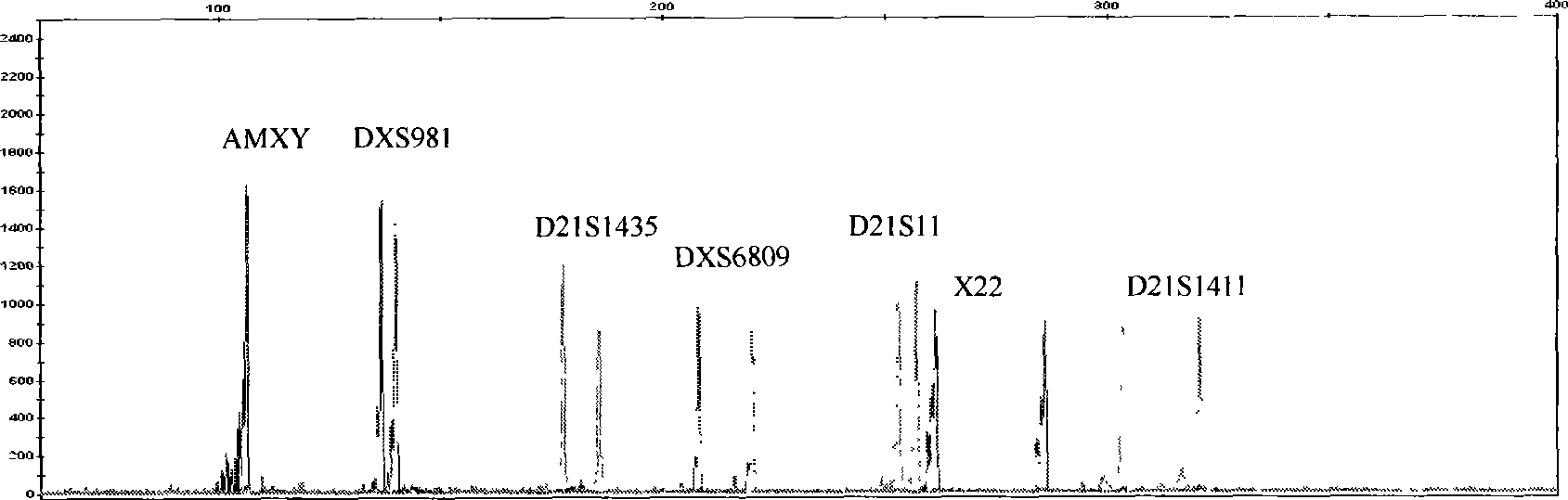 Reagent box for detecting No 21 chromosome and idiochromosome number abnormality