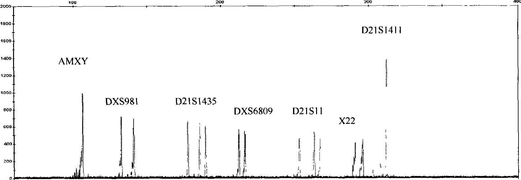 Reagent box for detecting No 21 chromosome and idiochromosome number abnormality