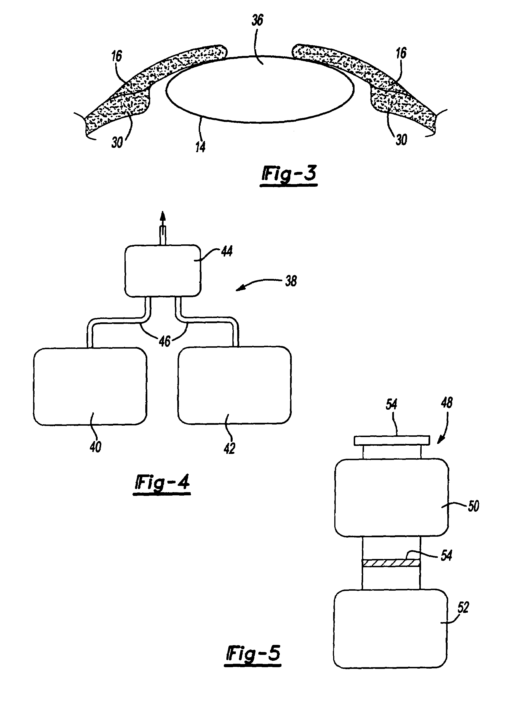 Ophthalmological surgery colorant and delivery system