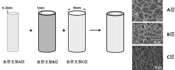 Polyamino acidic elastic vascular tissue engineering stent and preparation method thereof