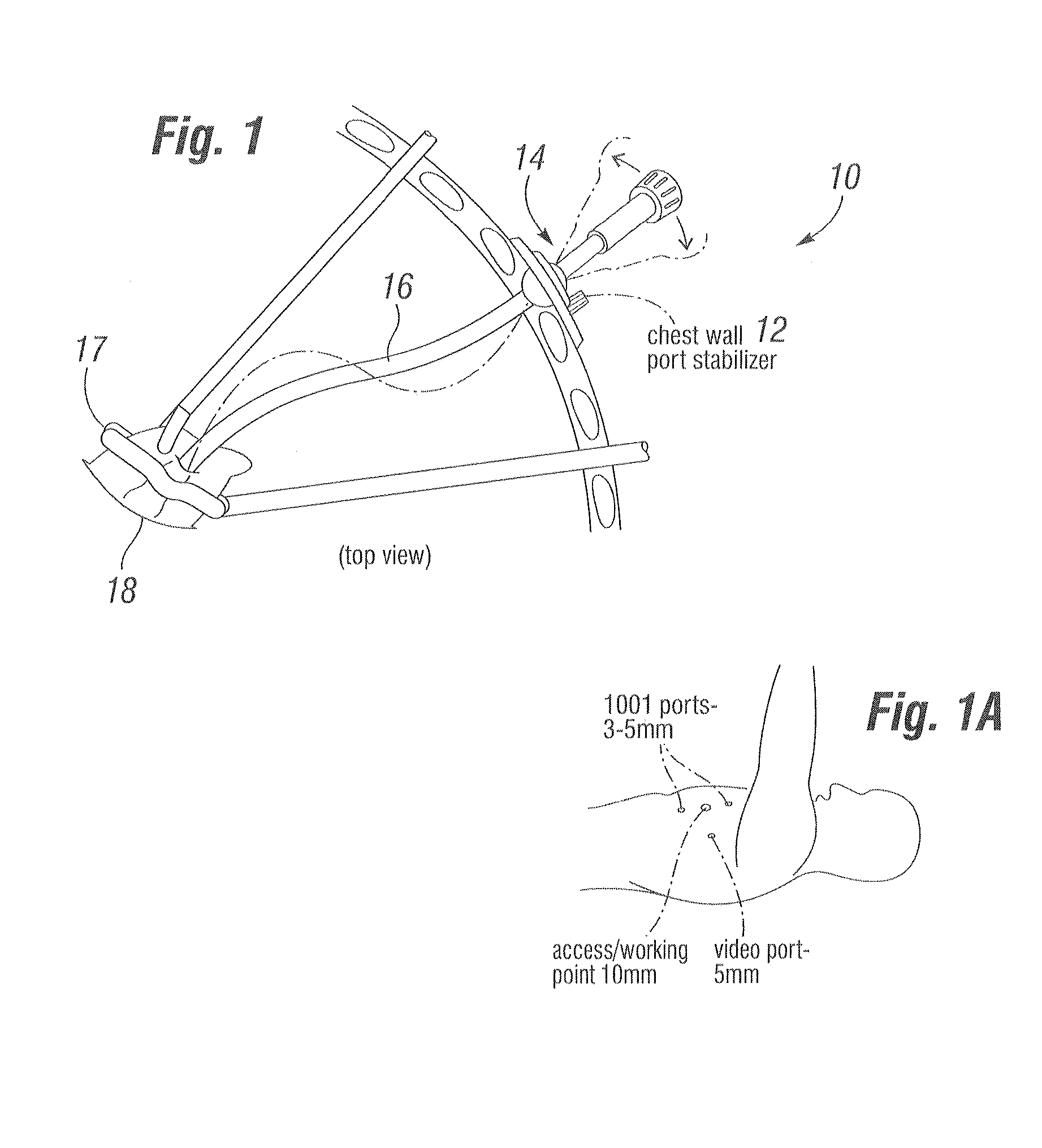 Surgical ablation system with chest wall platform