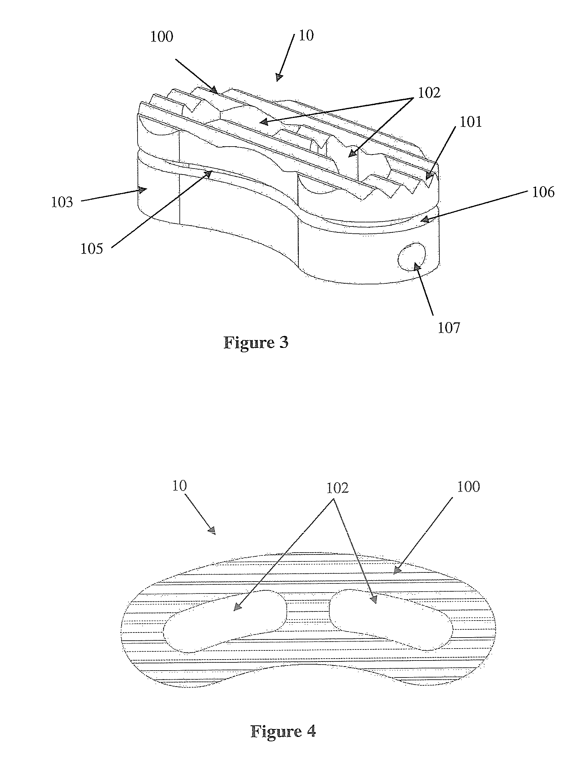 Load sharing interbody fusion device