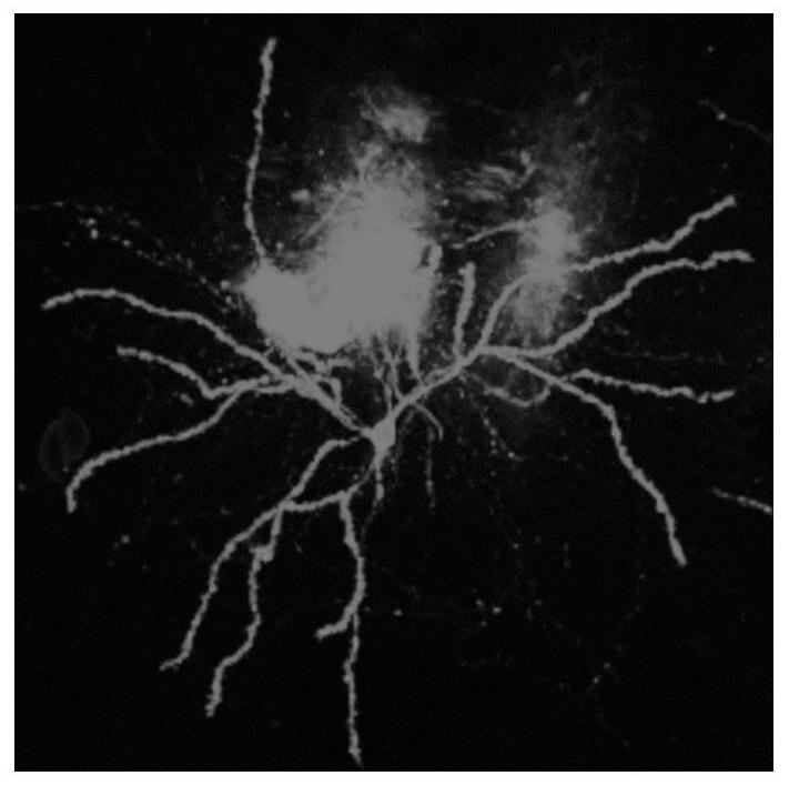 Method for detecting form of neuron dendritic spine in brain slice