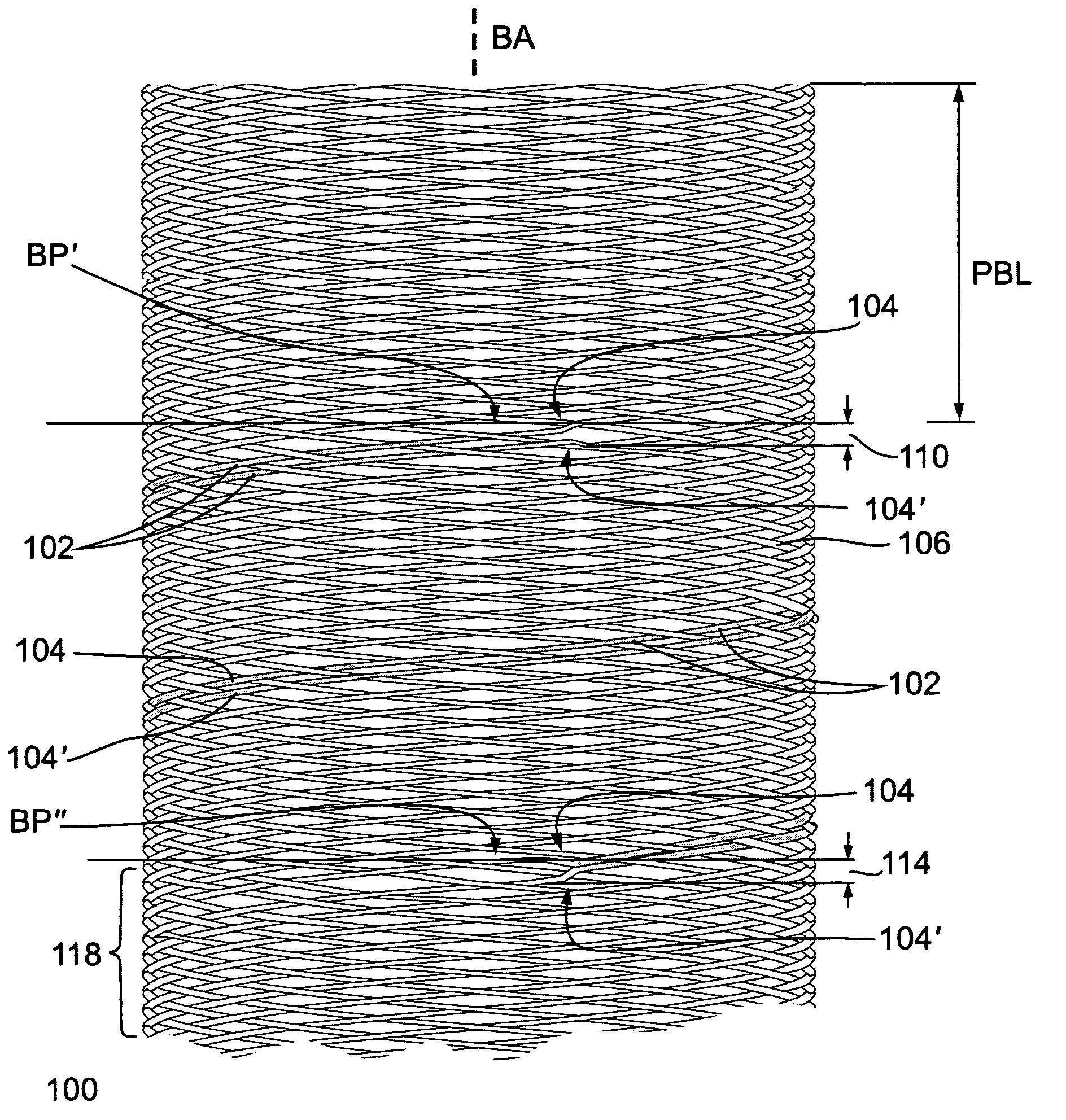 Striped braided element