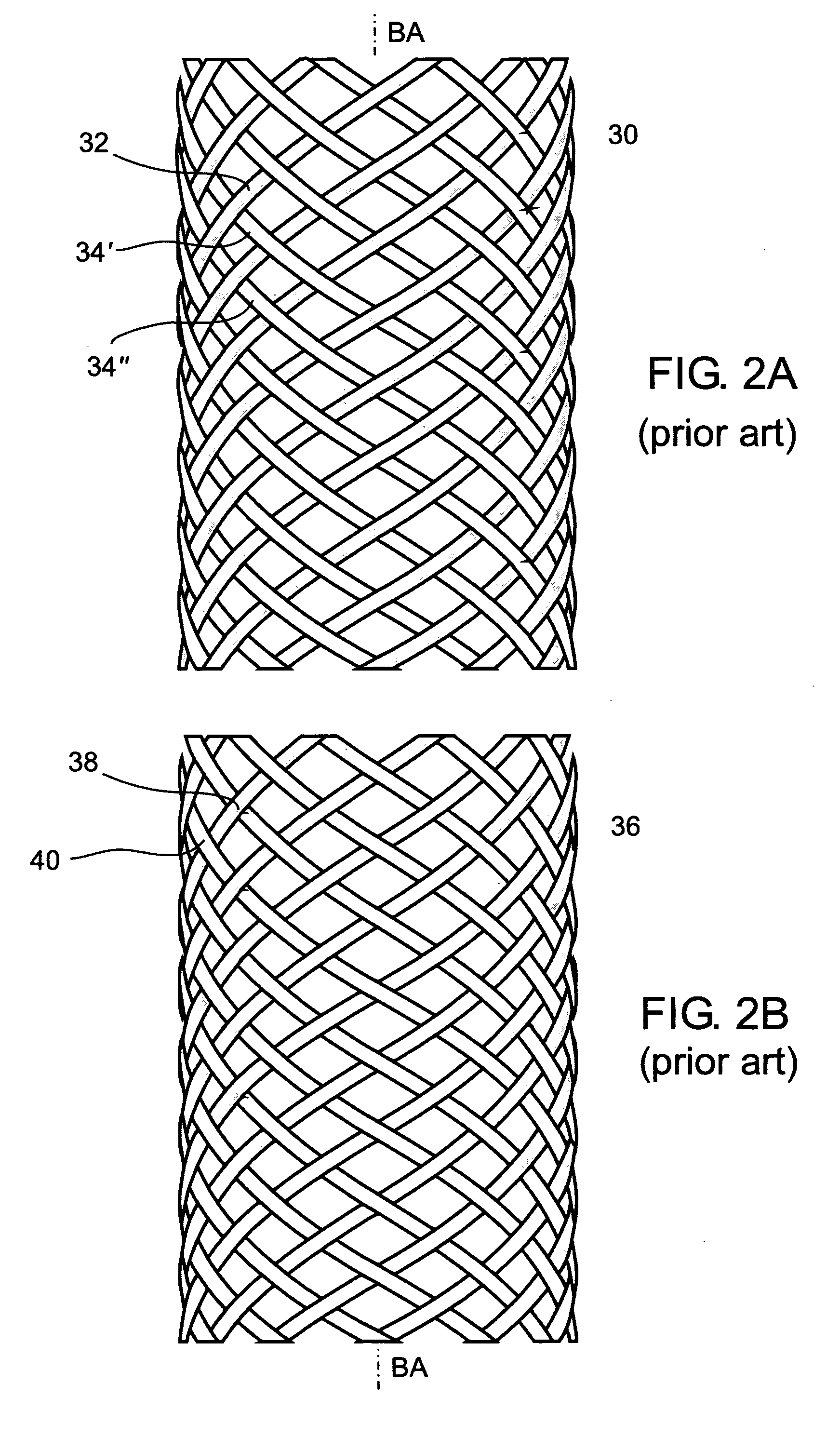 Striped braided element