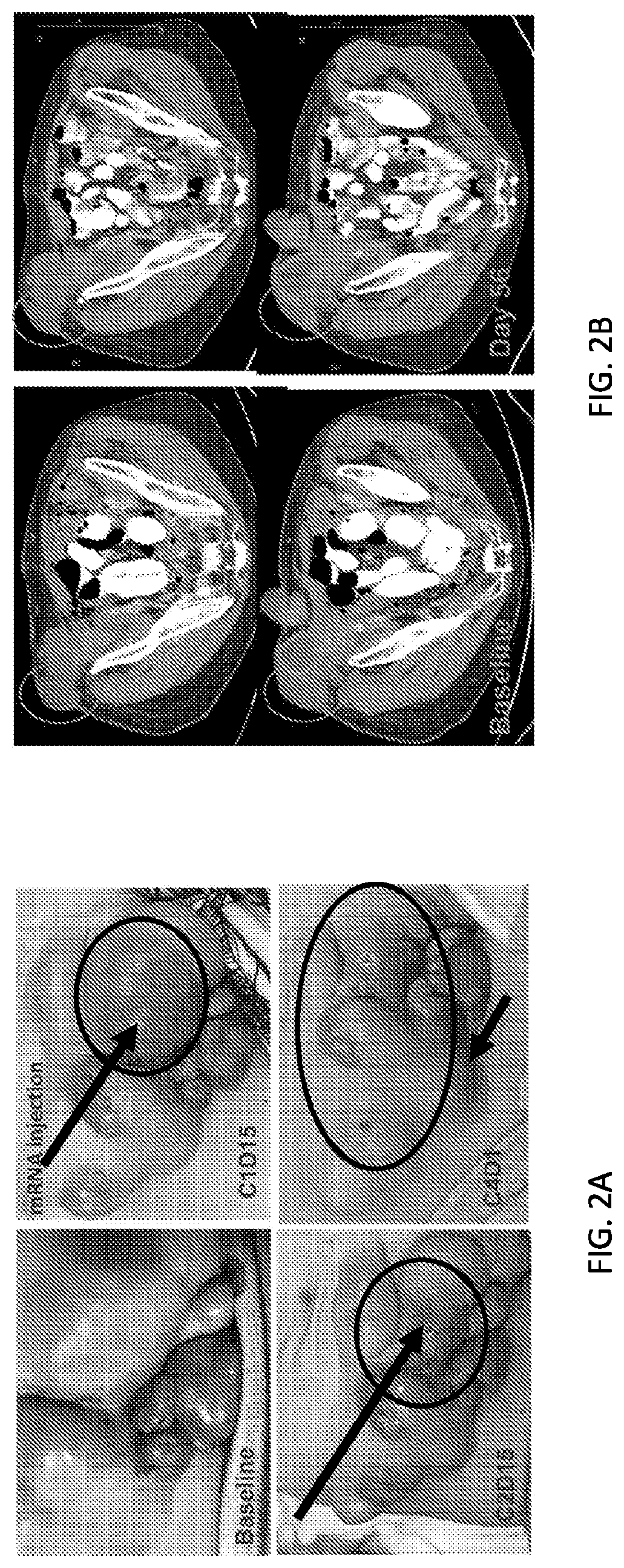 Use of mRNA encoding ox40l to treat cancer in human patients