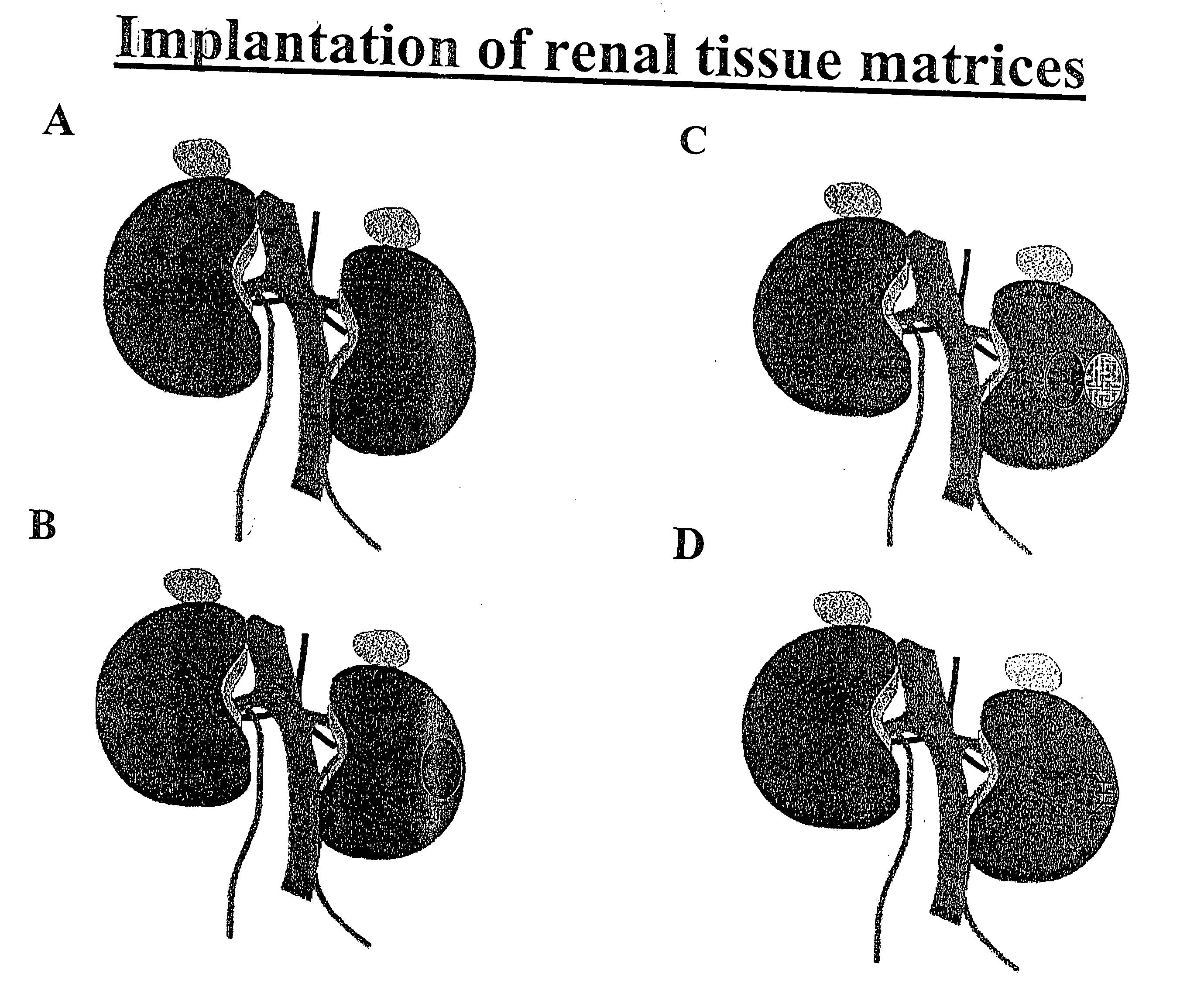 Augmentation of organ function