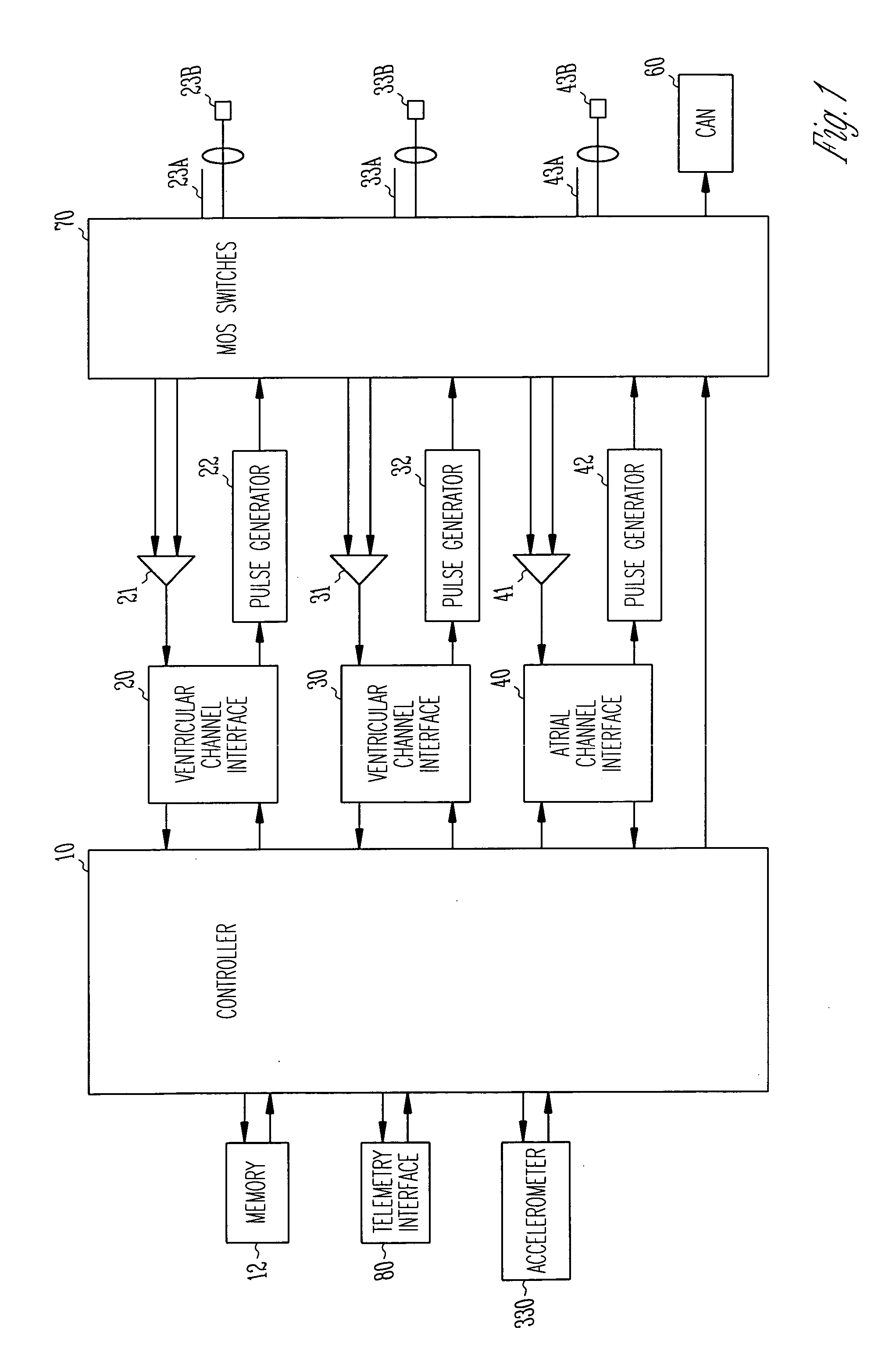 Method and apparatus for detecting acoustic oscillations in cardiac rhythm