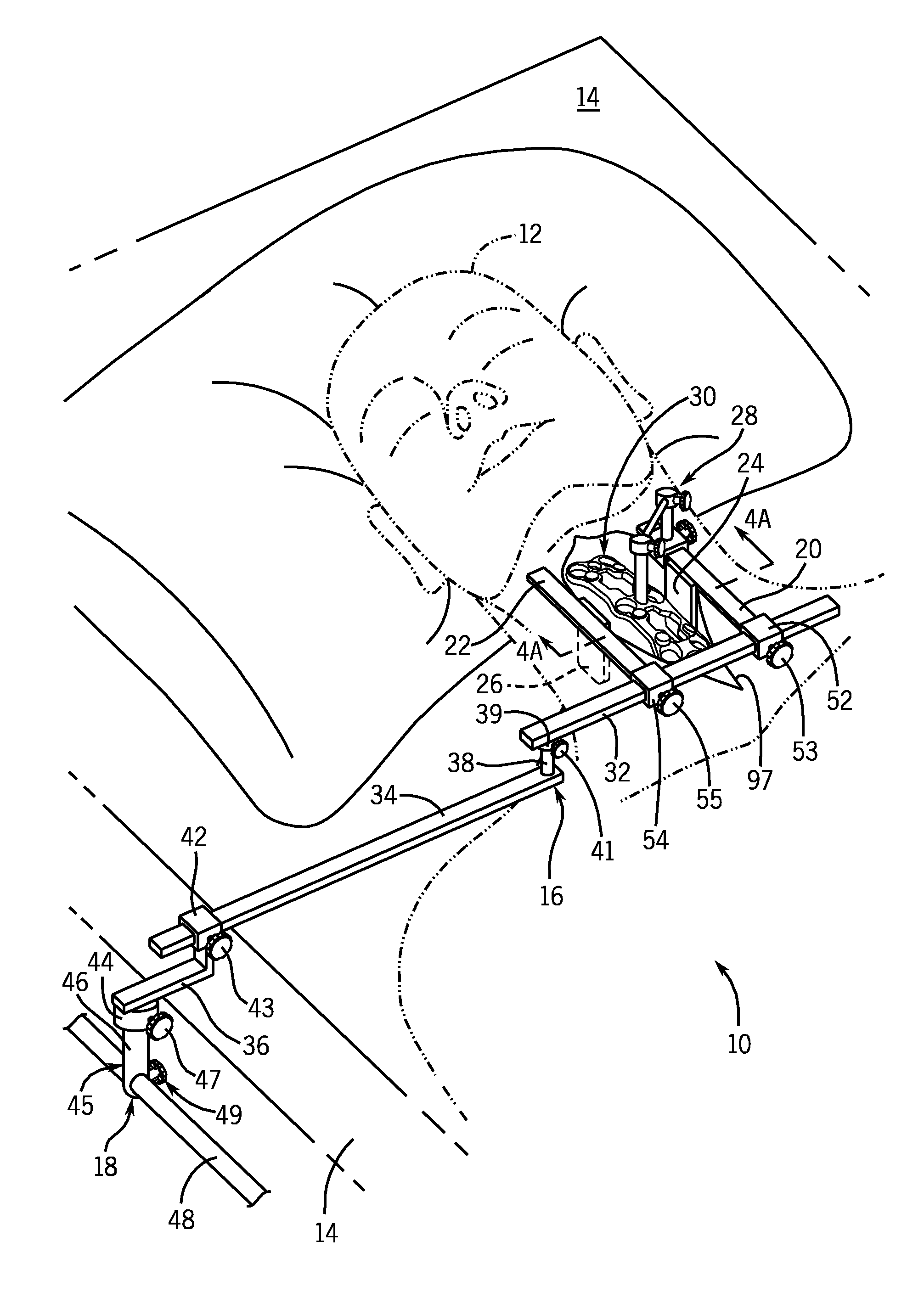 Anterior Cervical Retractor System