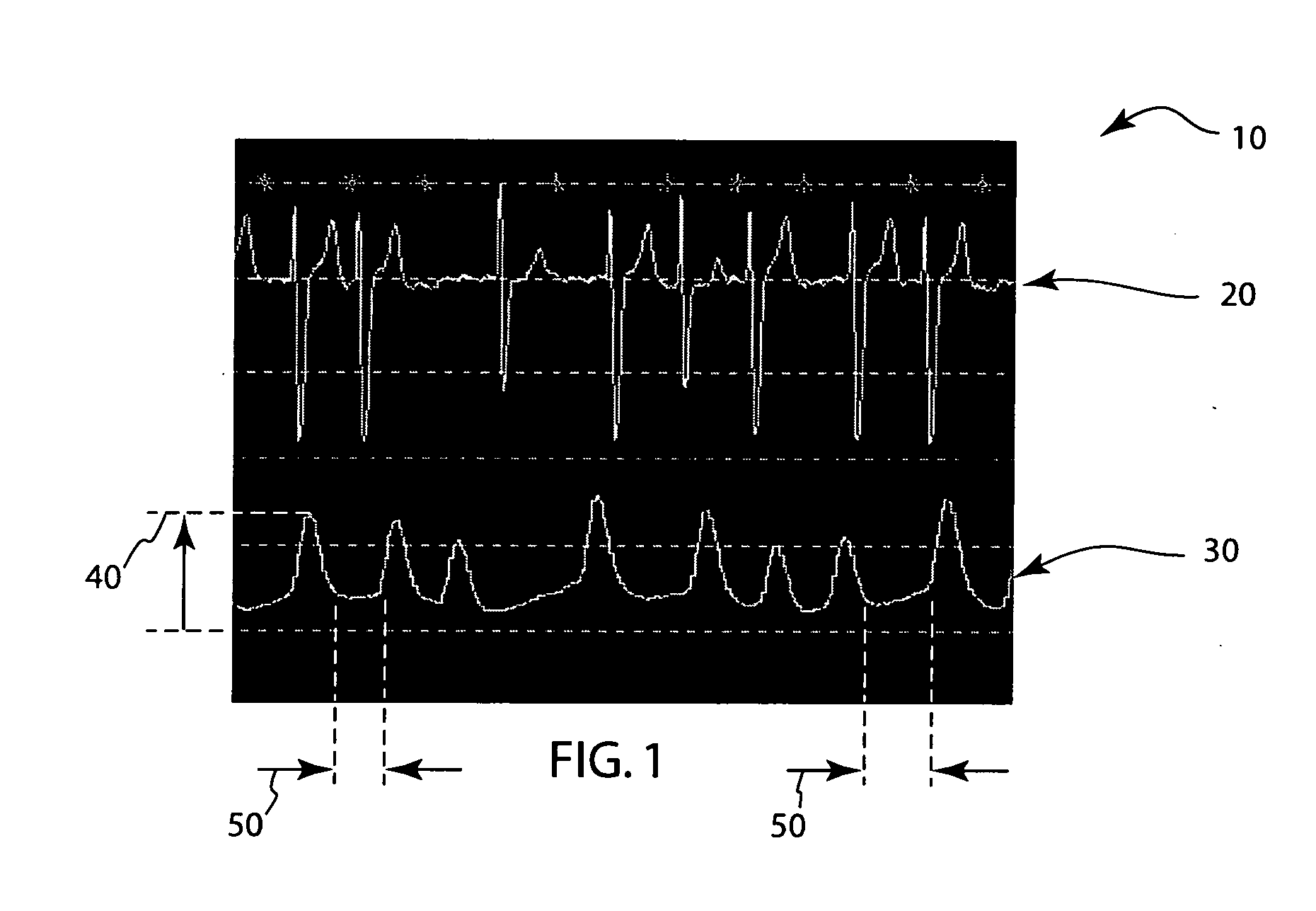 Atrial fibrillation detection using SPO2