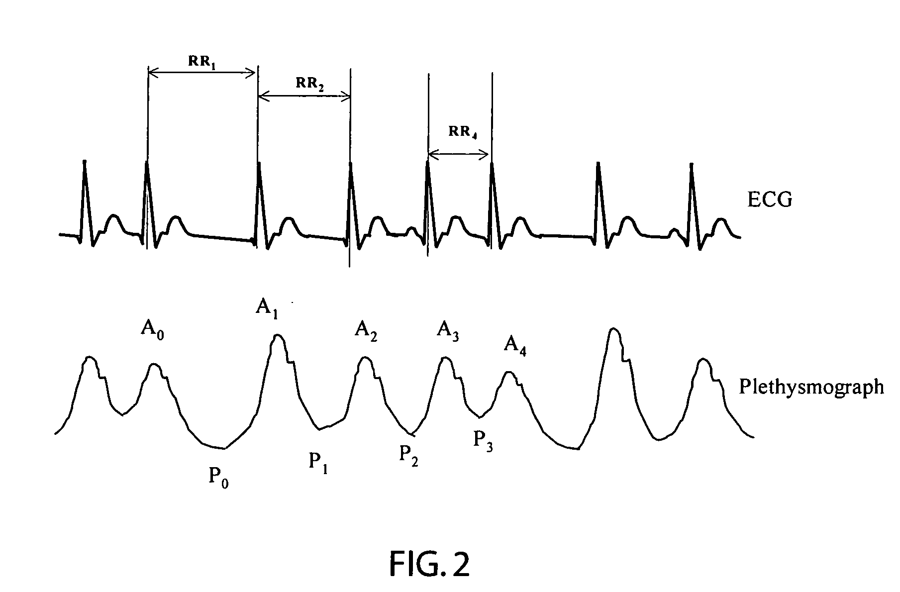 Atrial fibrillation detection using SPO2