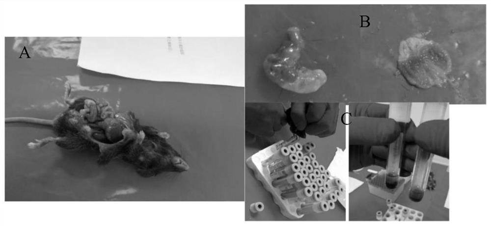 Application of Zhuzhu Darcy in inhibition of gastric mucosa inflammation caused by helicobacter pylori infection