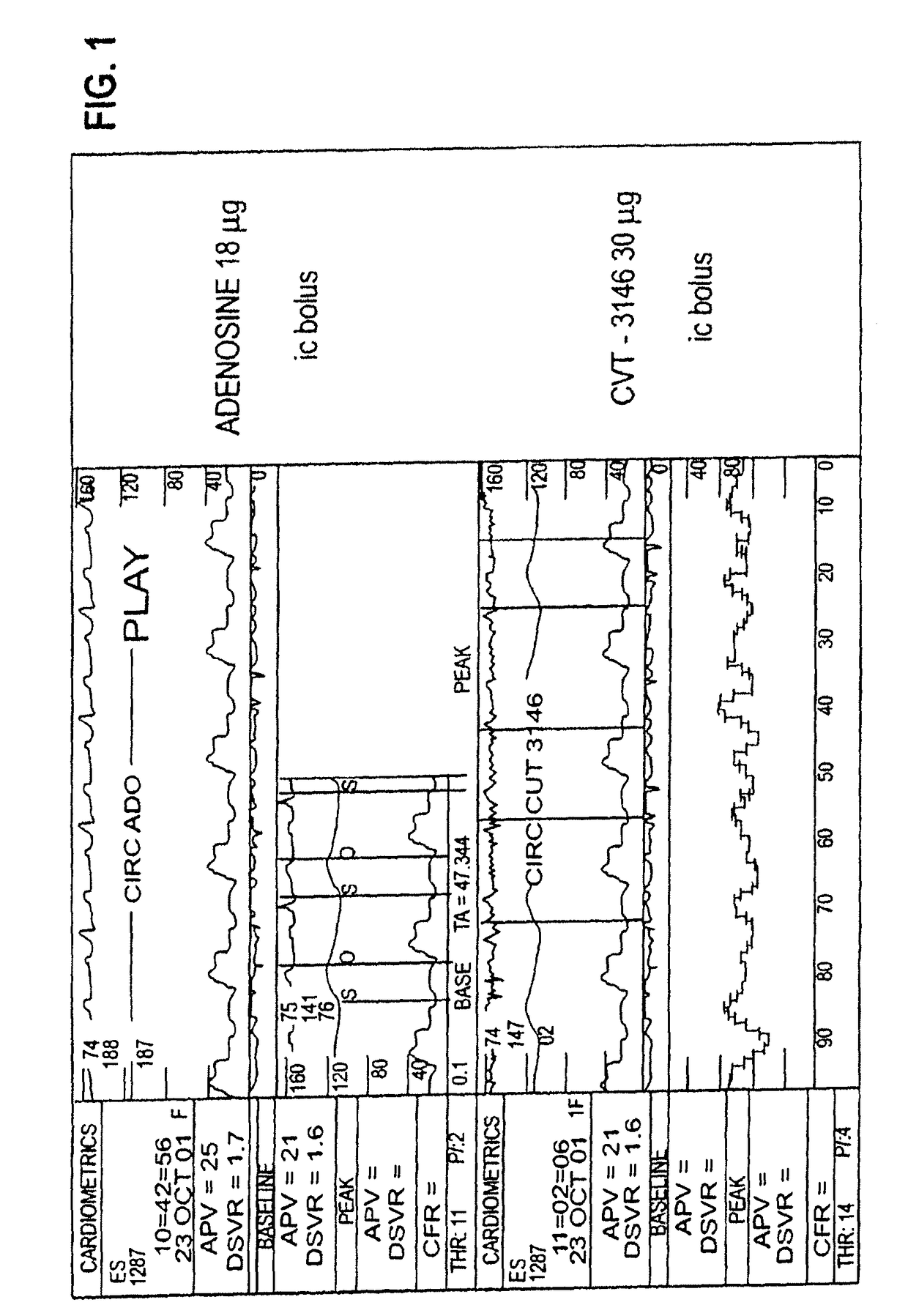 Myocardial perfusion imaging methods and compositions