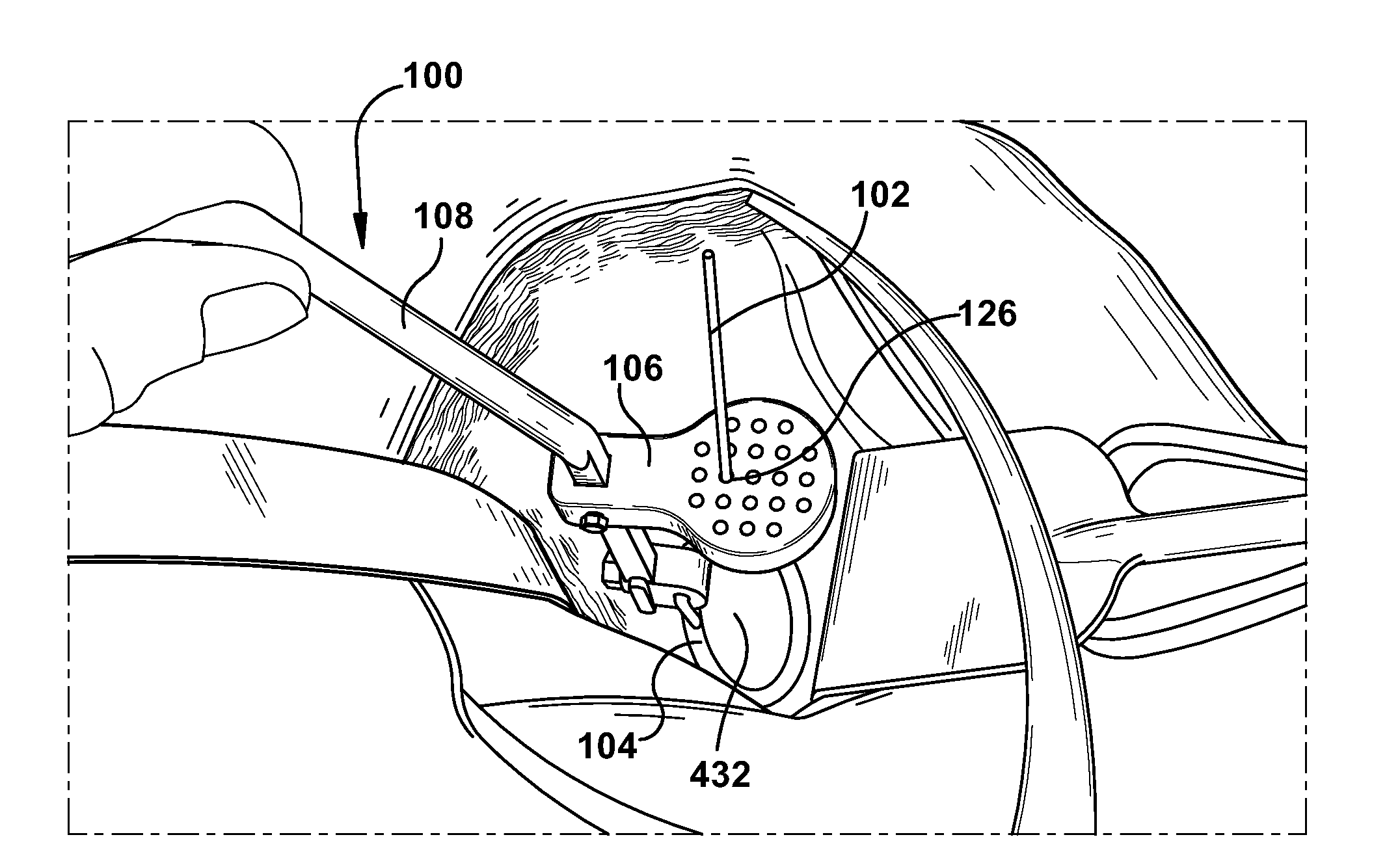 Method and apparatus for insertion of an elongate pin into a surface