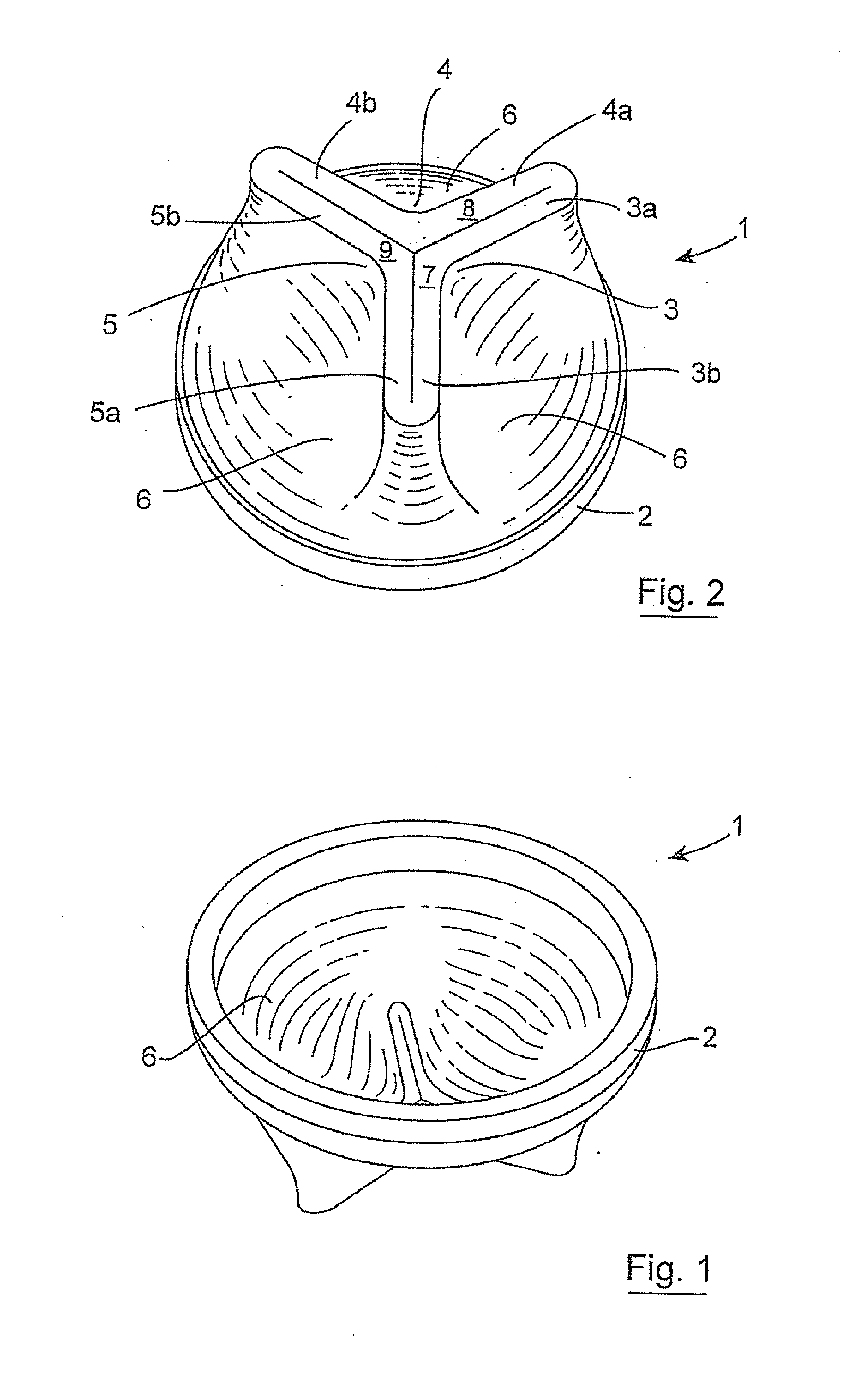 Luminal prosthesis and a gastrointestinal implant device